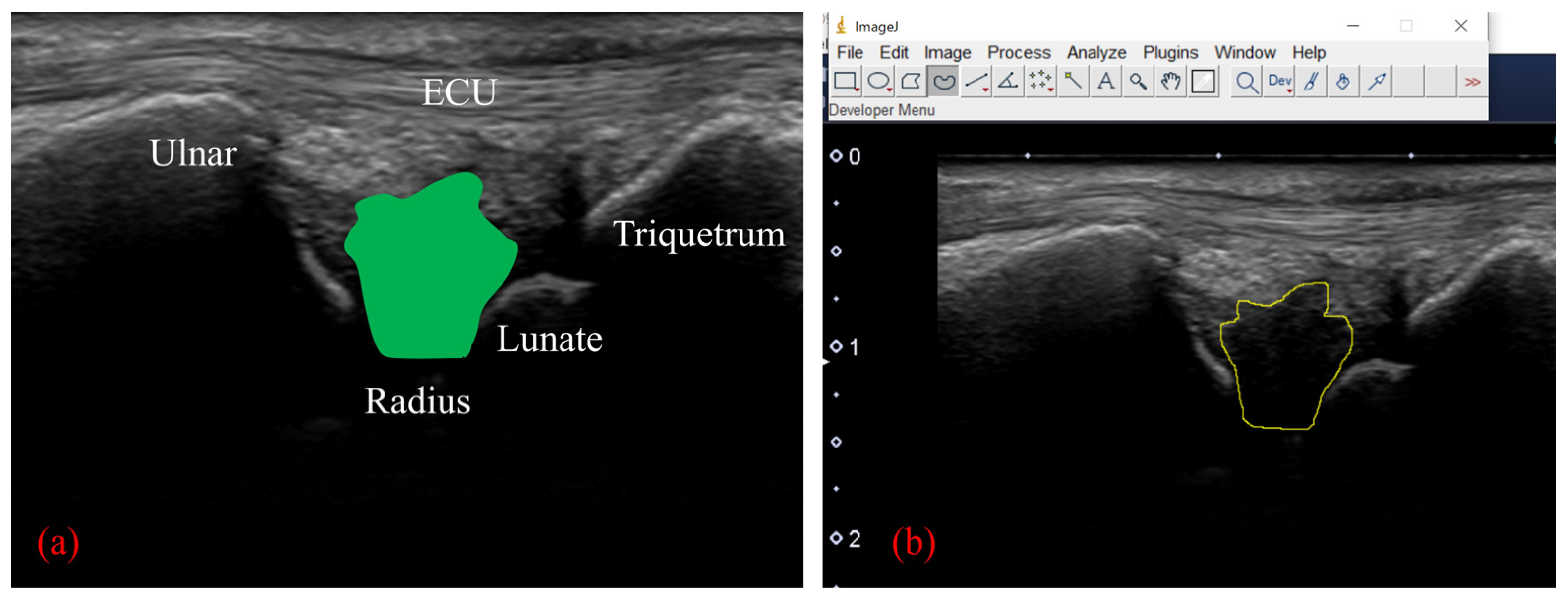 Sensors 22 00345 g004