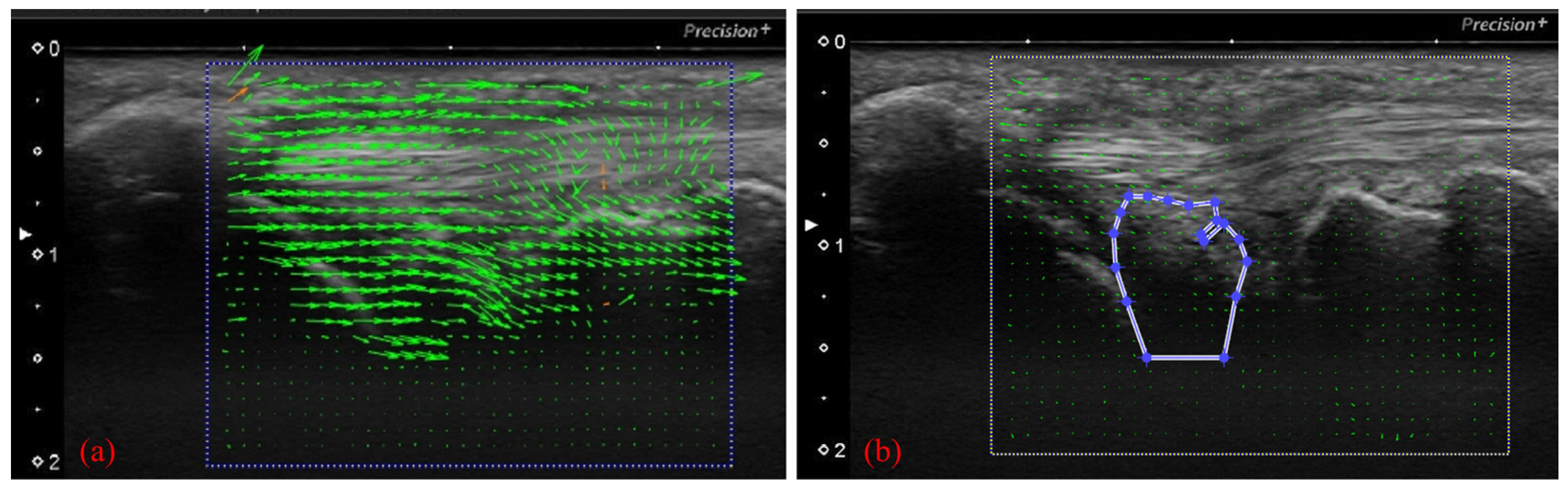 Sensors 22 00345 g005