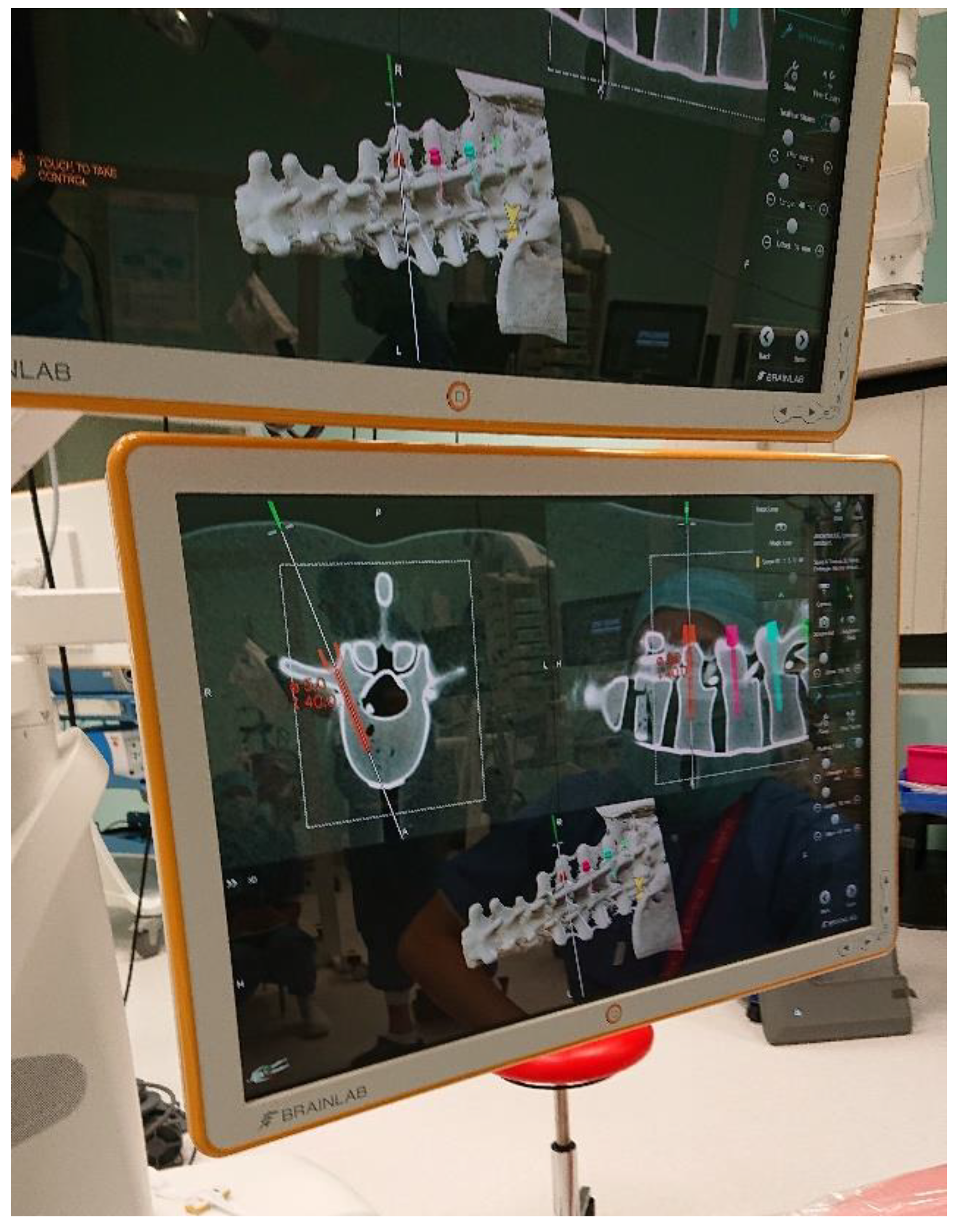 Sensors 22 00522 g002