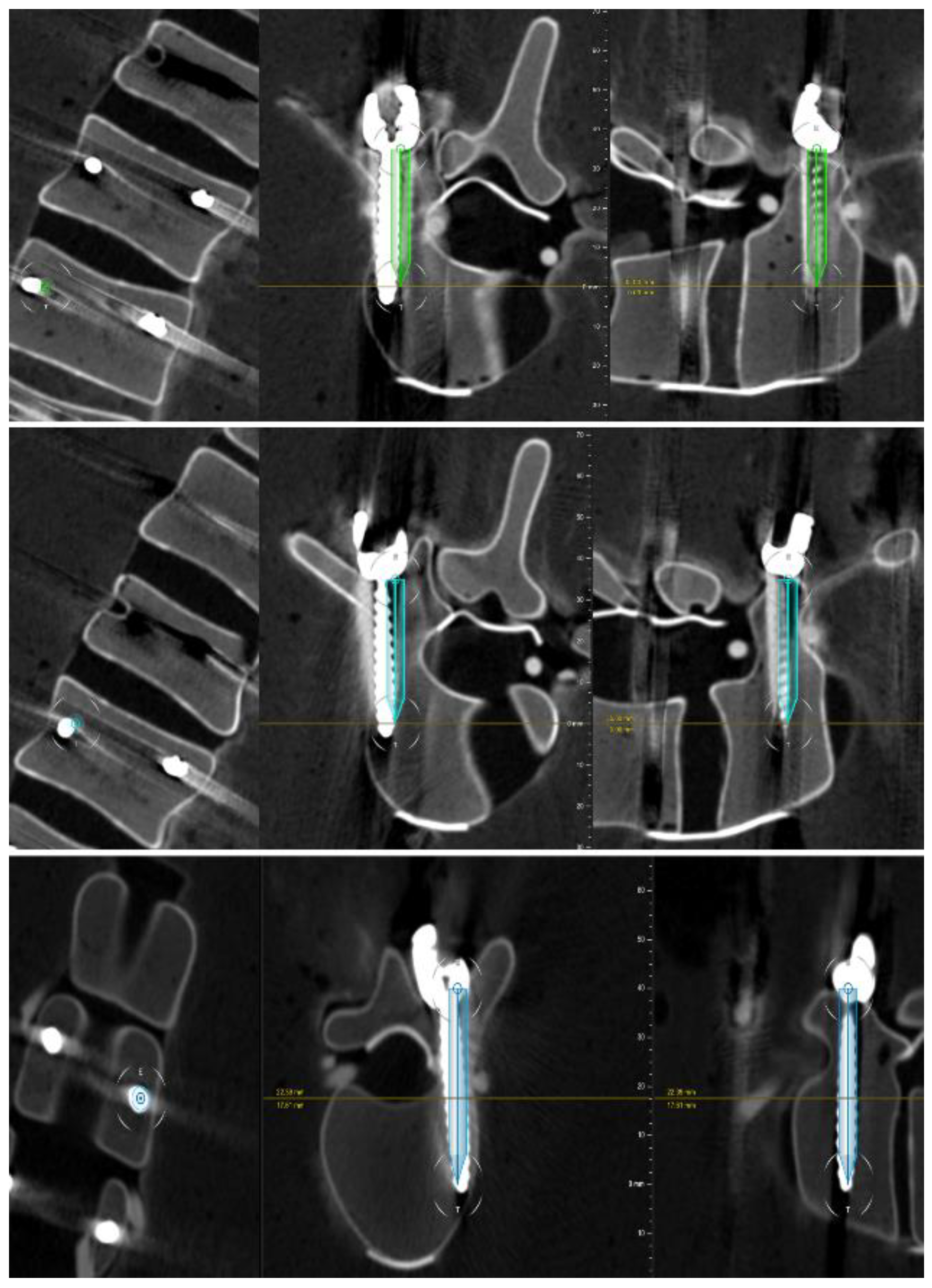 Sensors 22 00522 g008