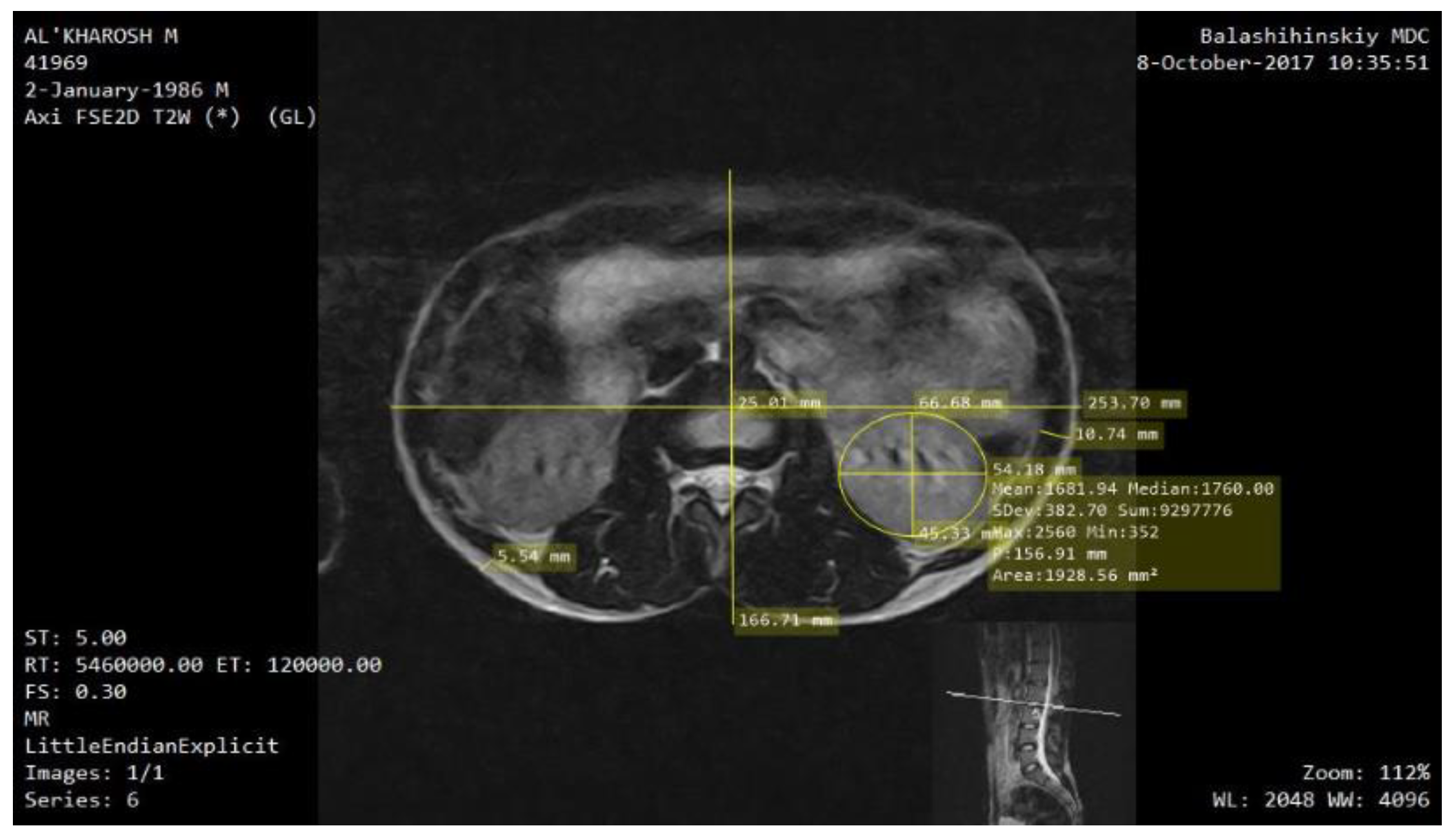Sensors 22 00606 g002