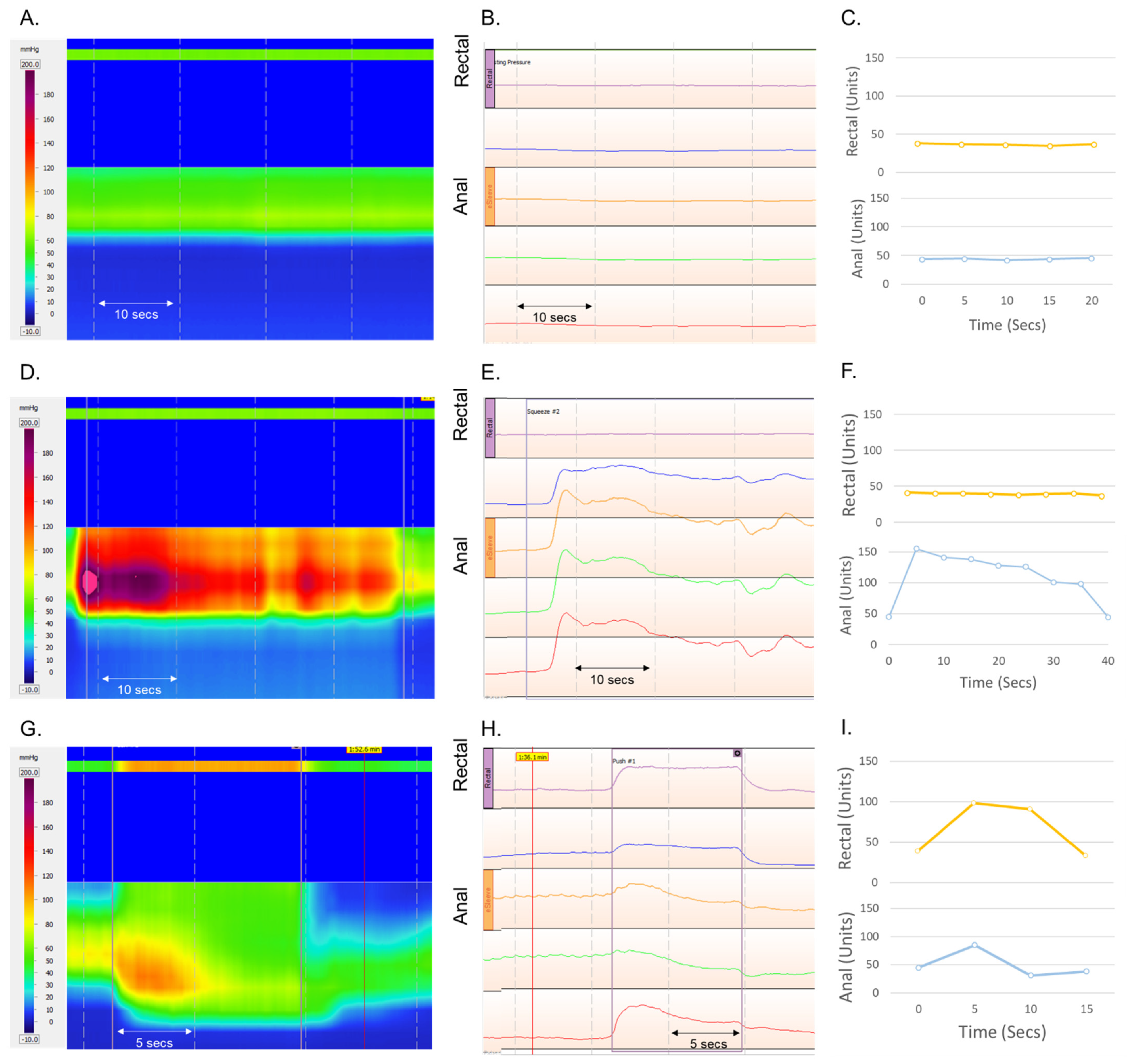 Sensors 22 00625 g009