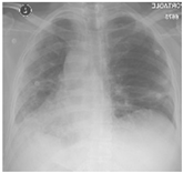 Sensors 22 00669 i001