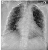 Sensors 22 00669 i002