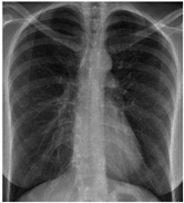 Sensors 22 00669 i004