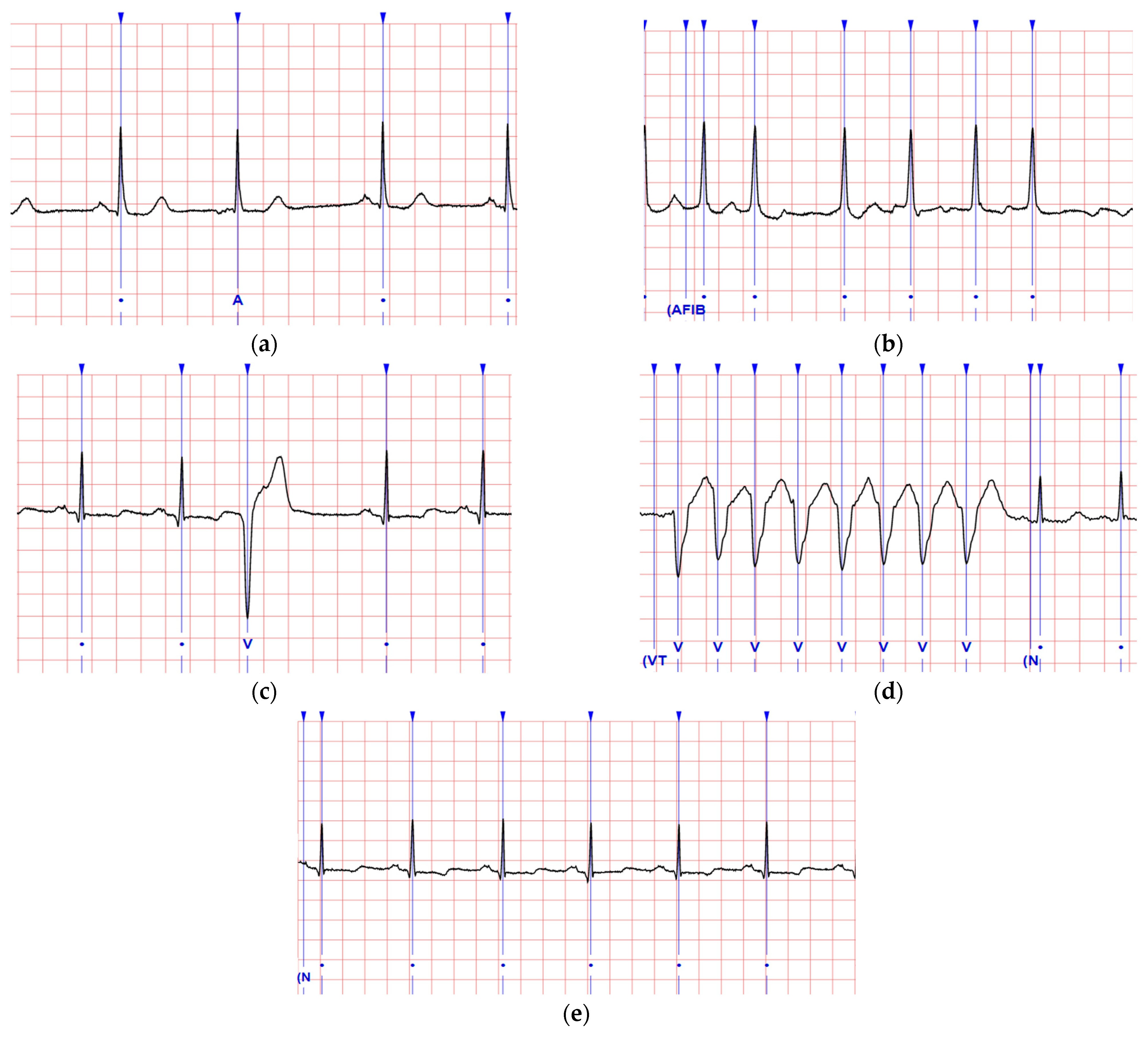 Sensors 22 00689 g002