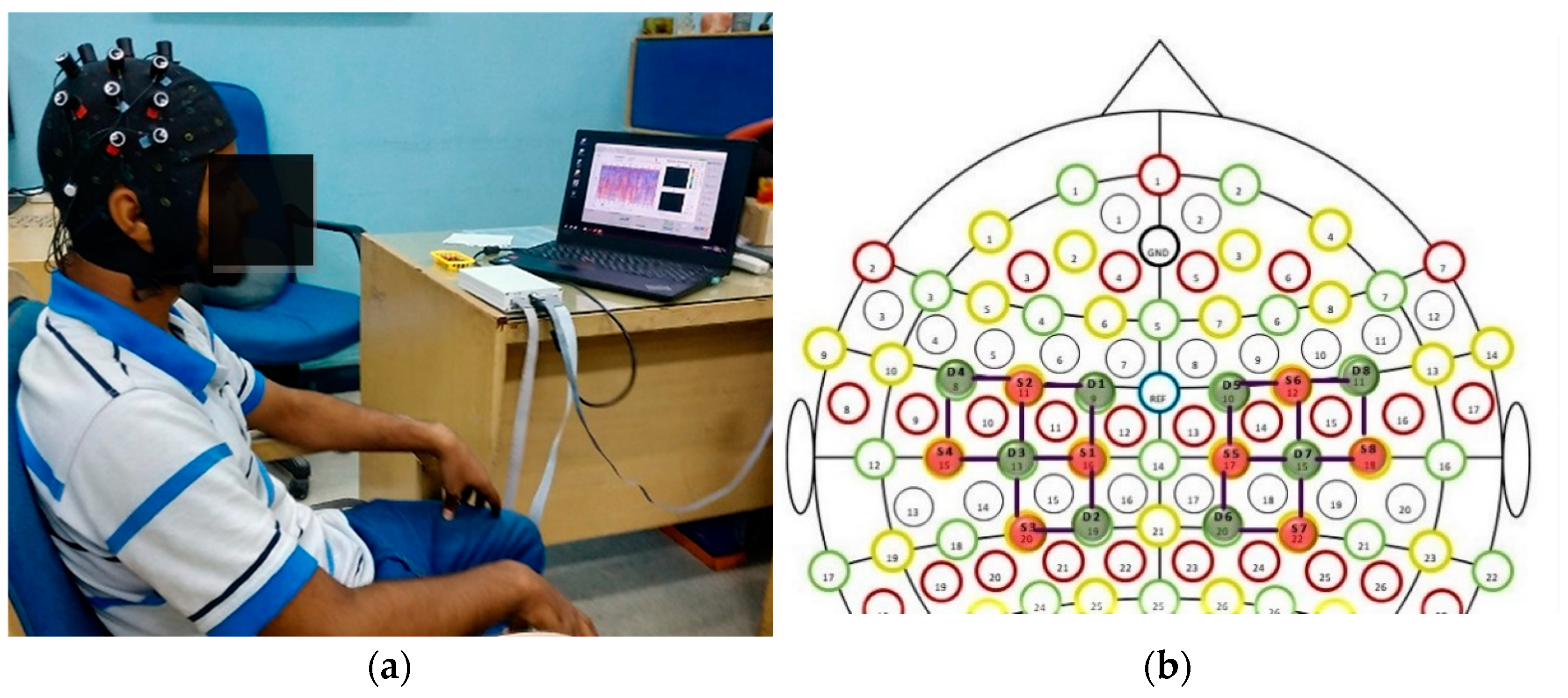 Sensors 22 00726 g003