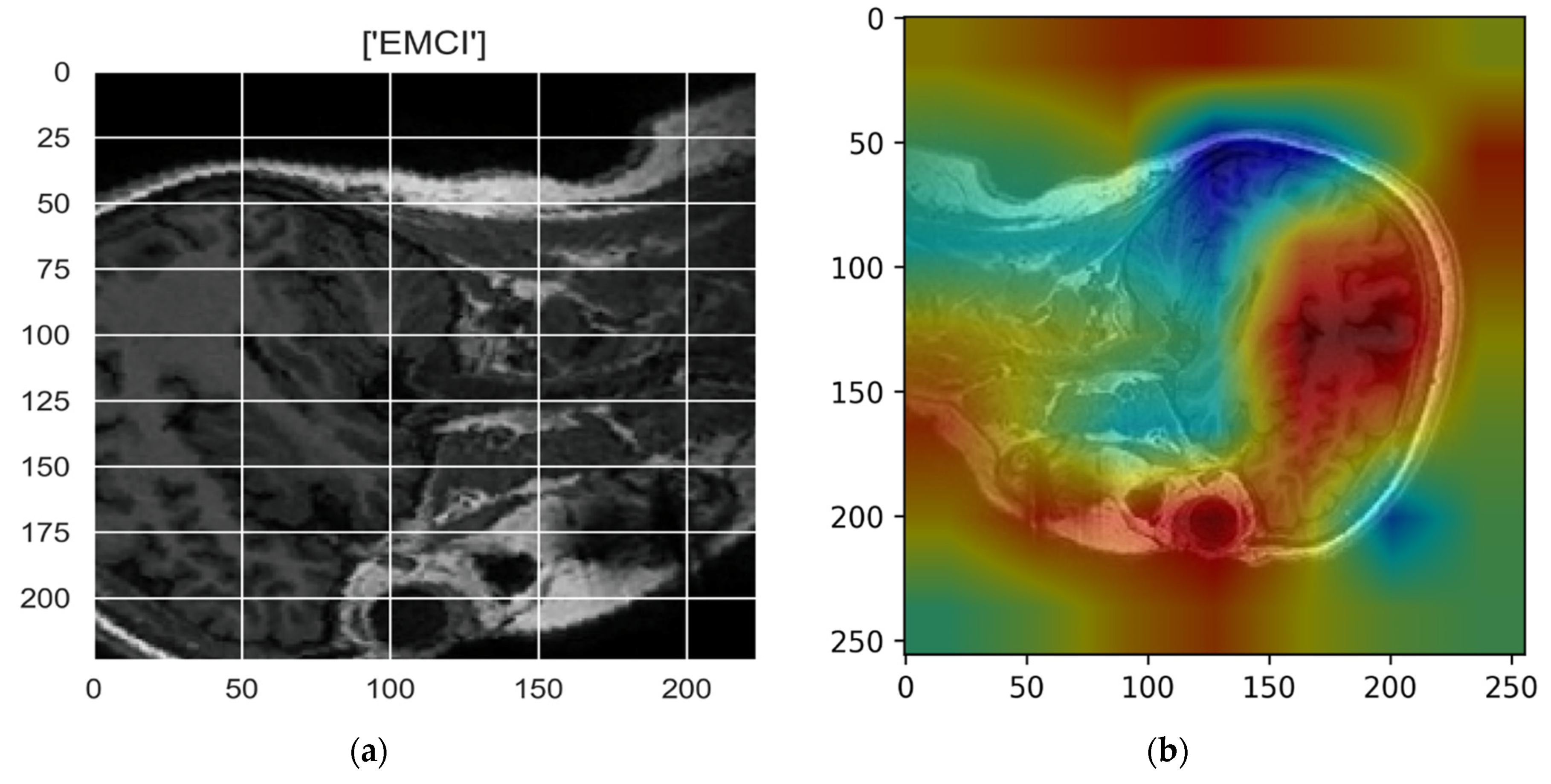 Sensors 22 00740 g011