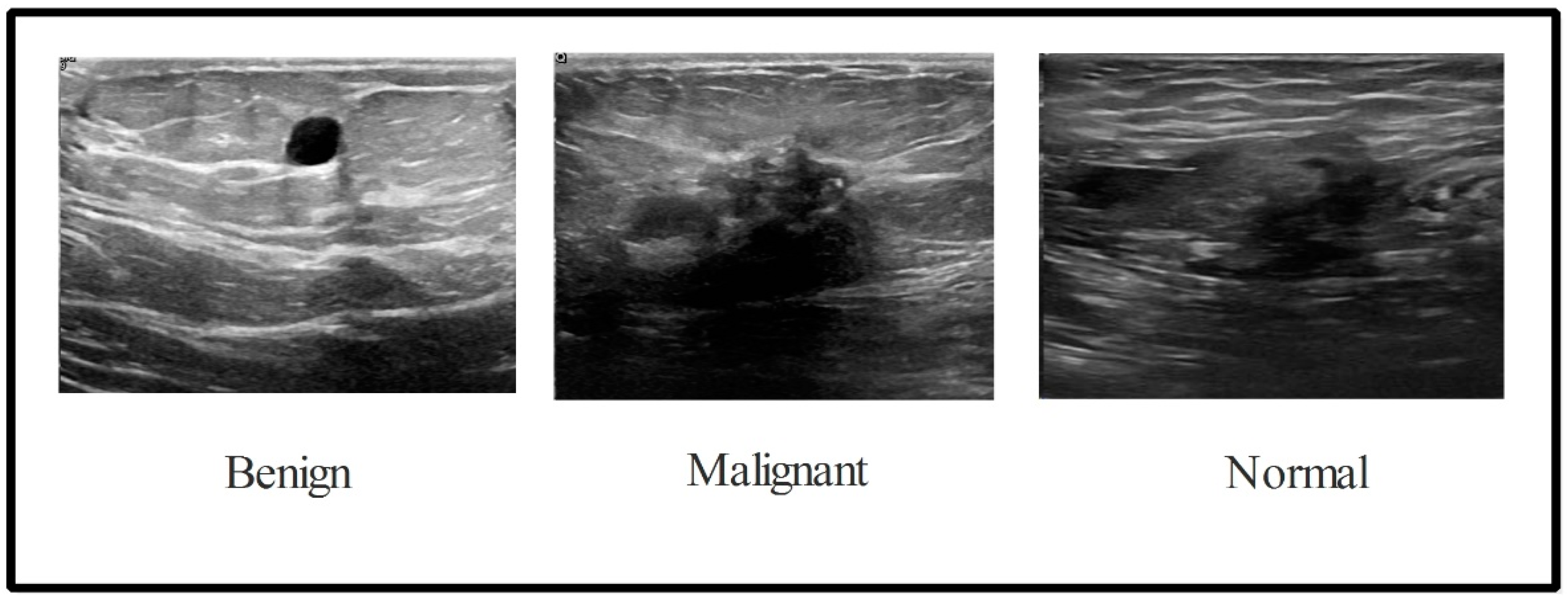 Sensors 22 00807 g002