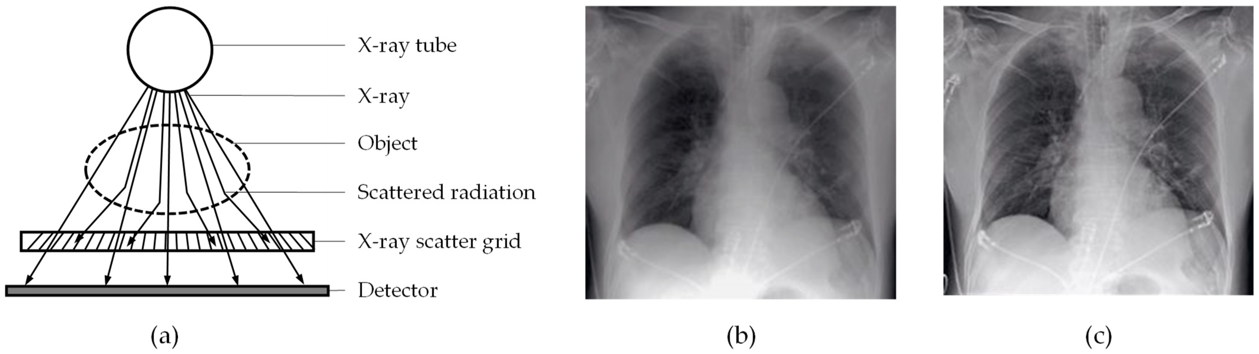 Sensors 22 00811 g001