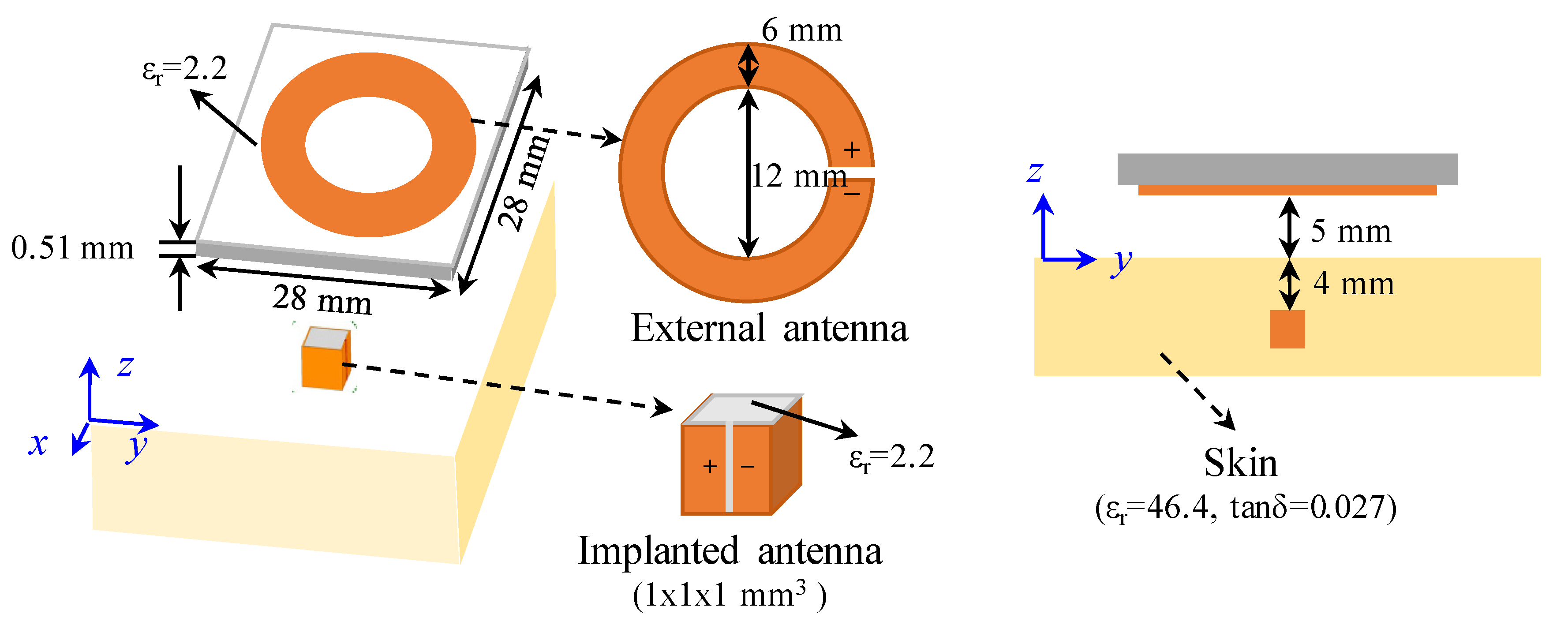 Sensors 22 00947 g0a1