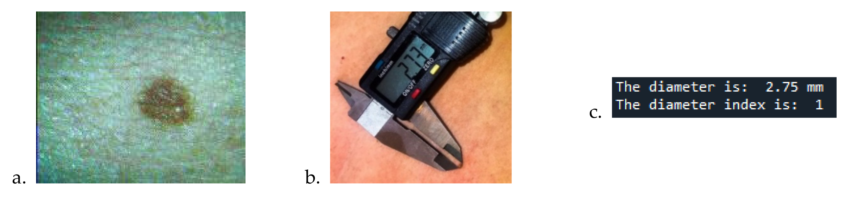 Sensors 22 01123 g008