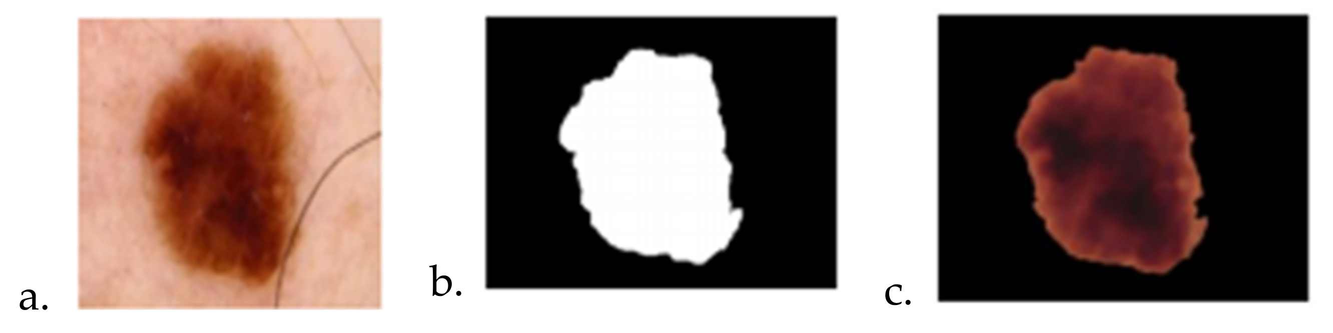 Sensors 22 01123 g011