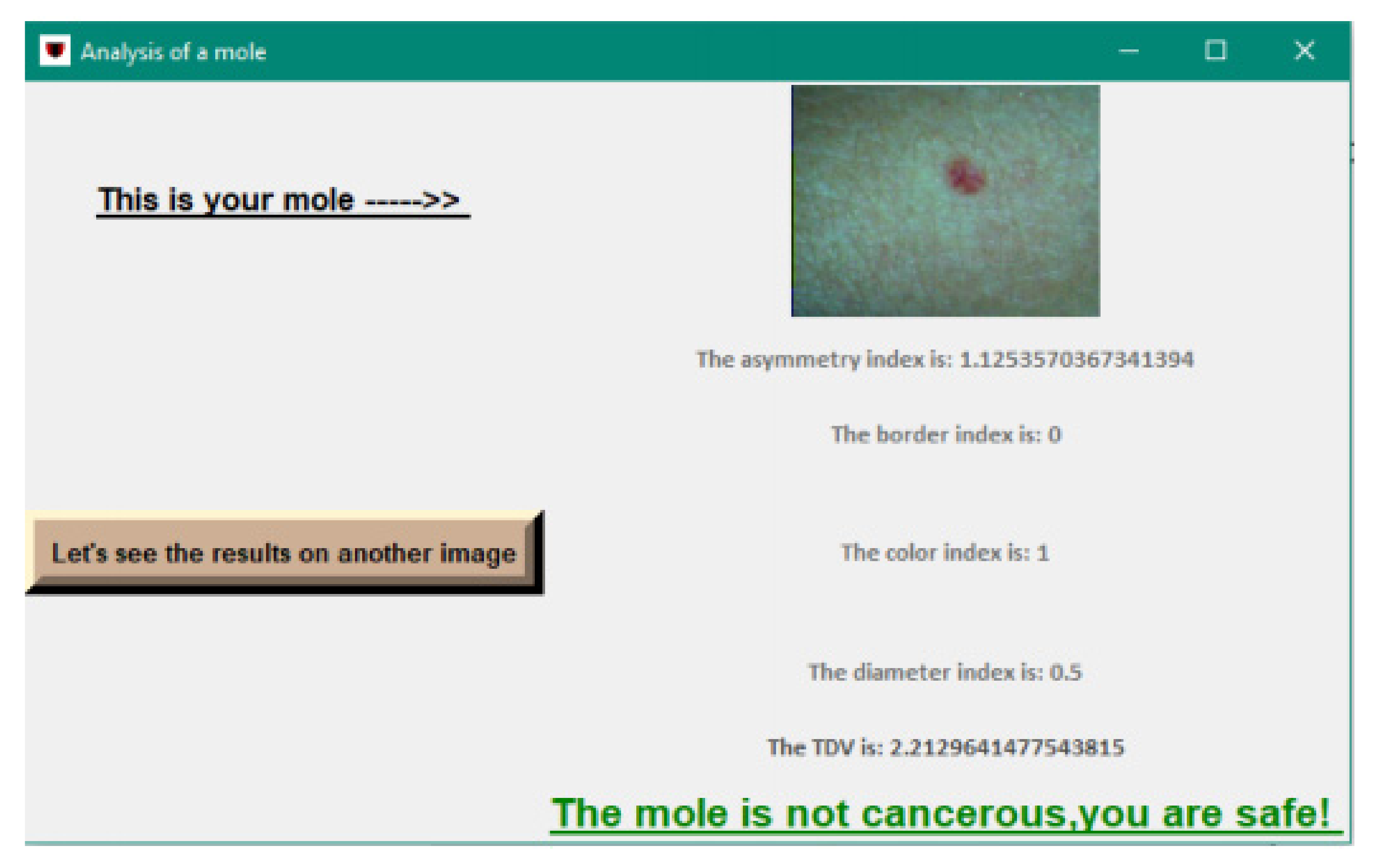 Sensors 22 01123 g013