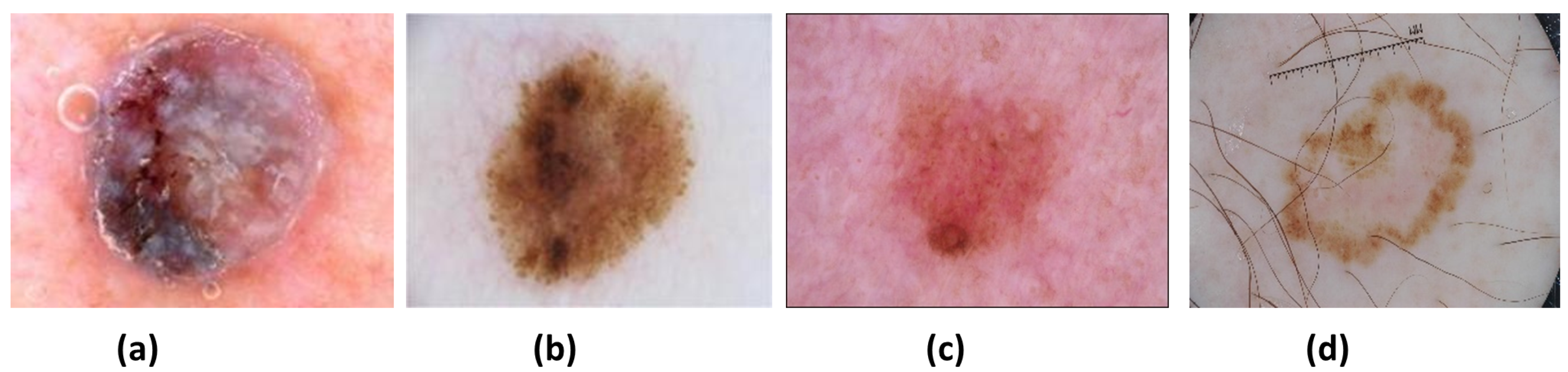 Sensors 22 01134 g001