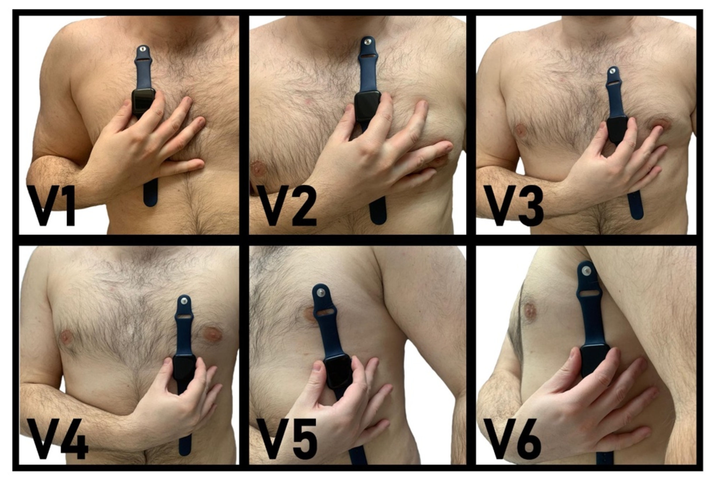 Sensors 22 01217 g001