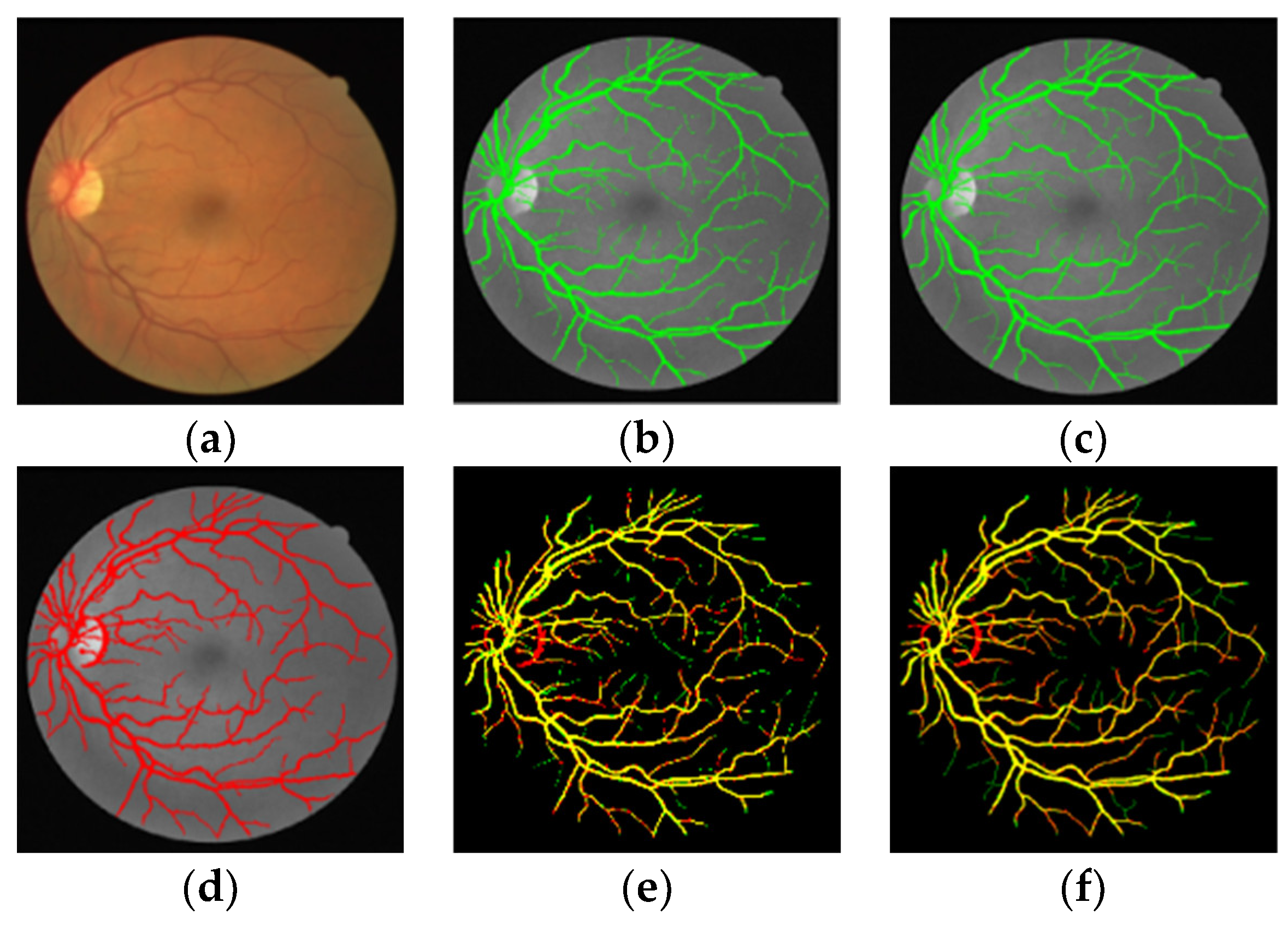 Sensors 22 01258 g006
