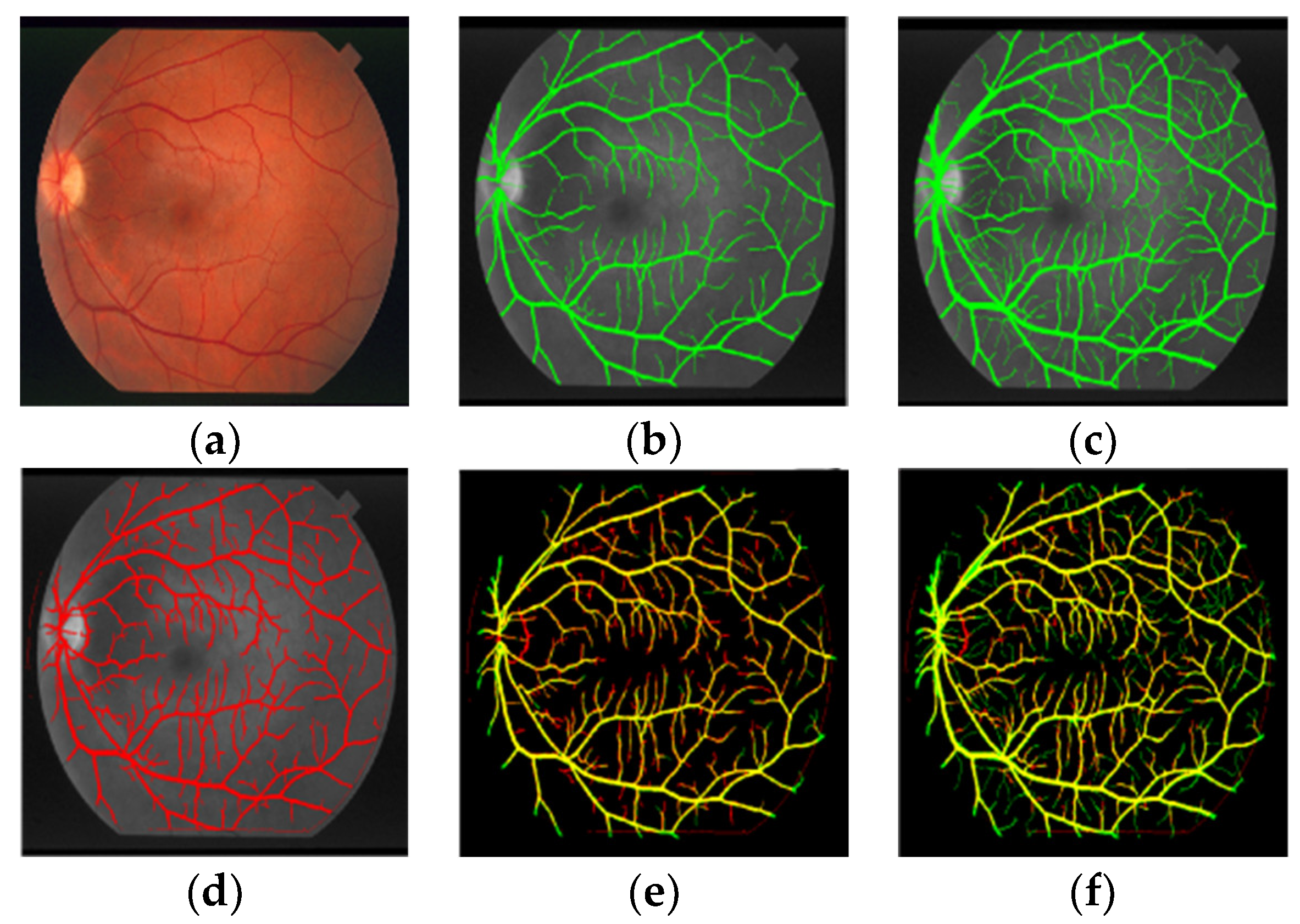 Sensors 22 01258 g007
