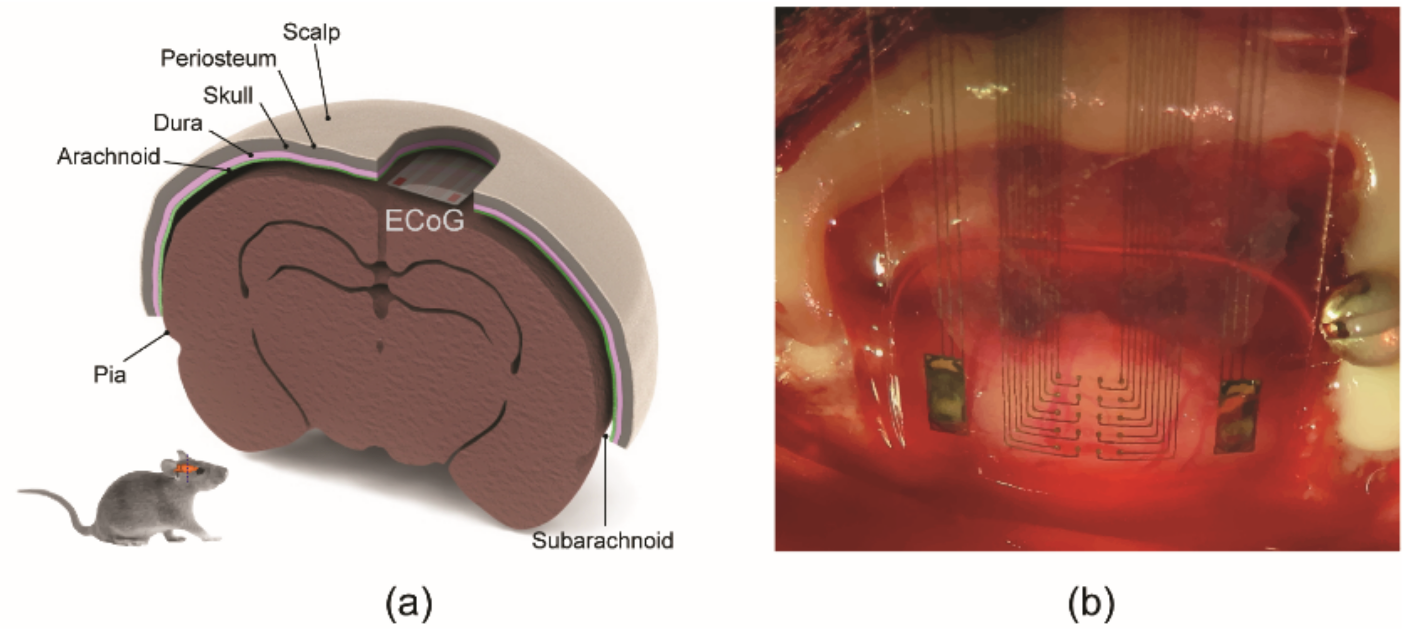 An Inkjet Printed Flexible Electrocorticography (ECoG) Microelectrode ...
