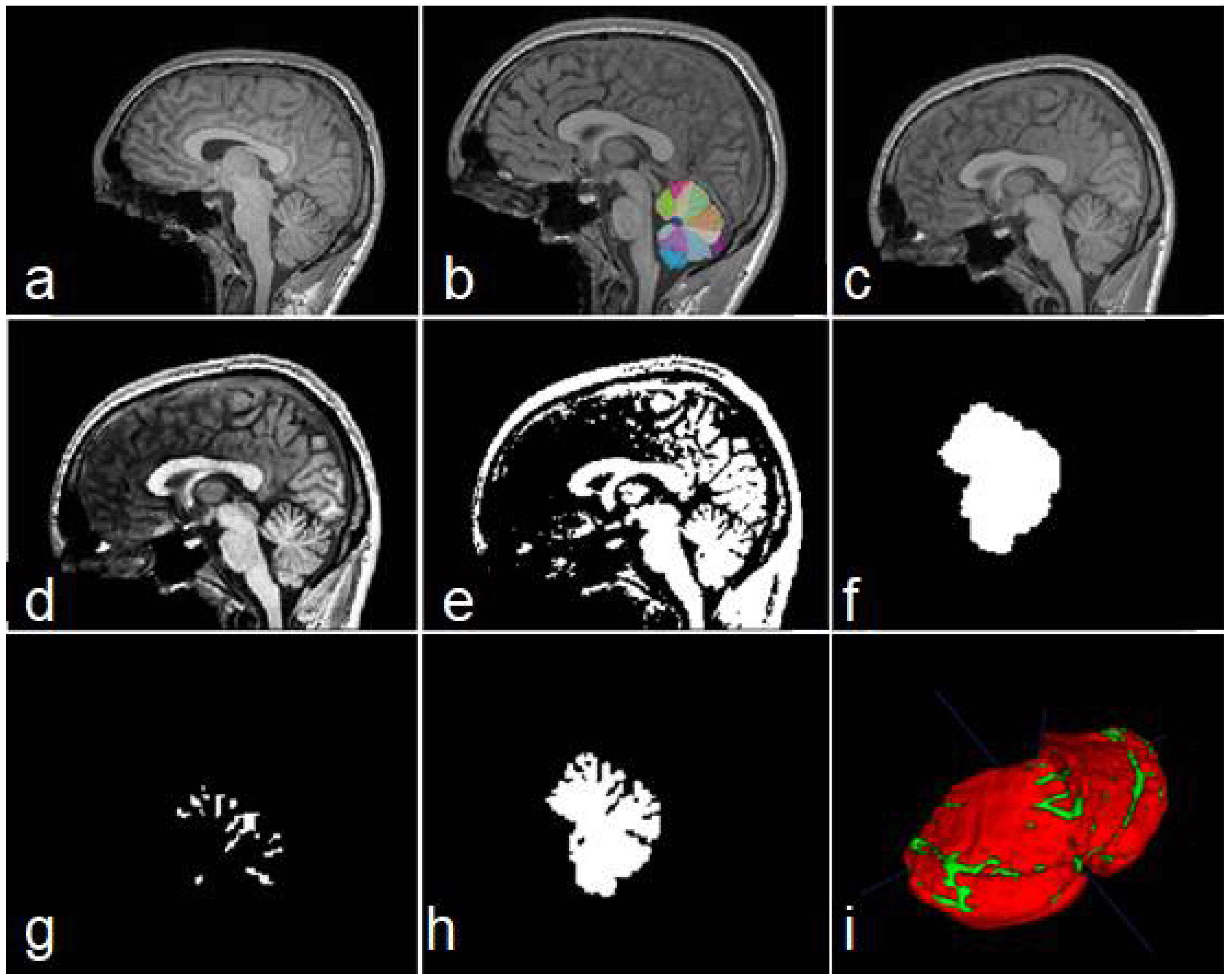 Sensors 22 01345 g003
