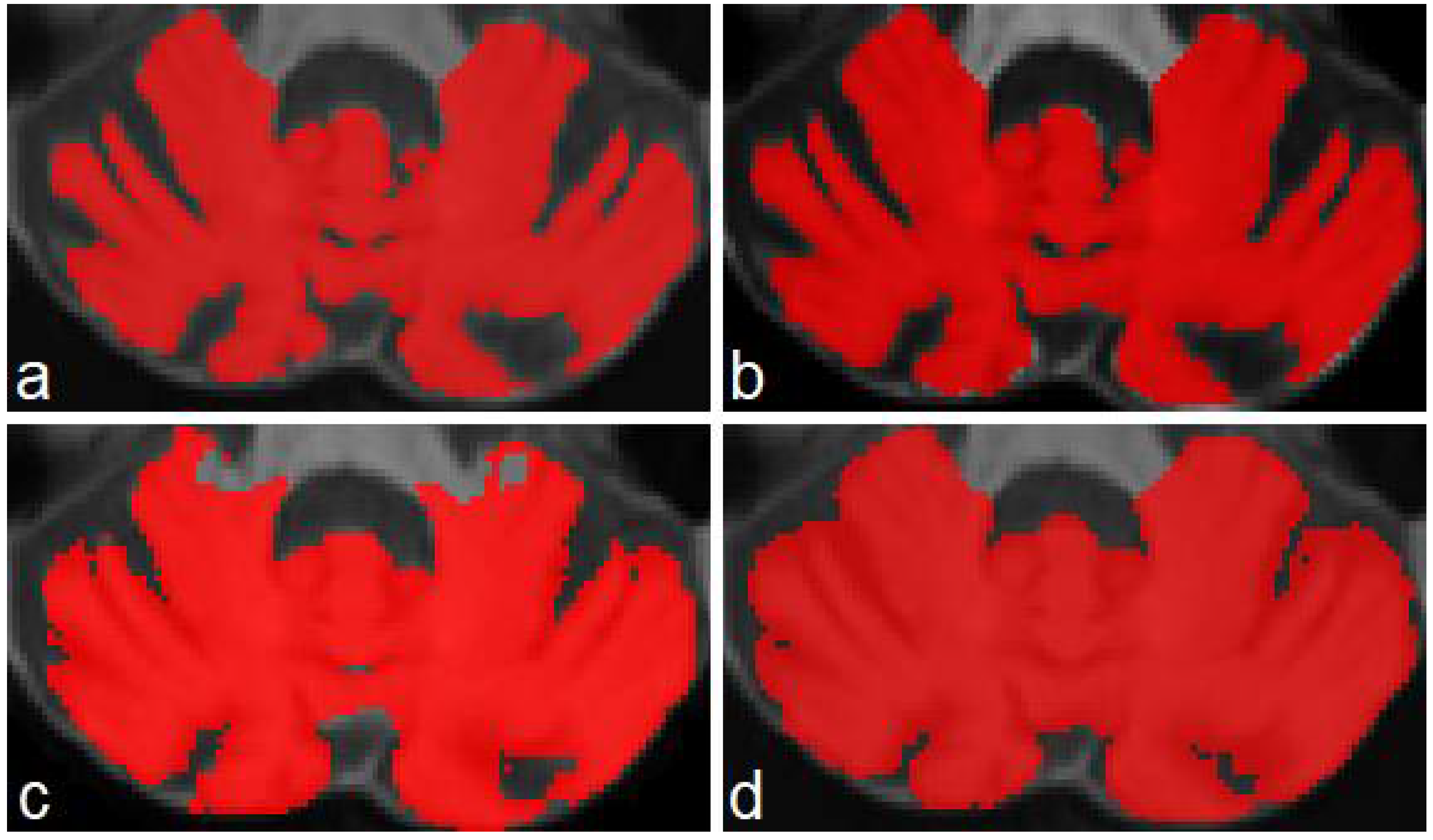 Sensors 22 01345 g005