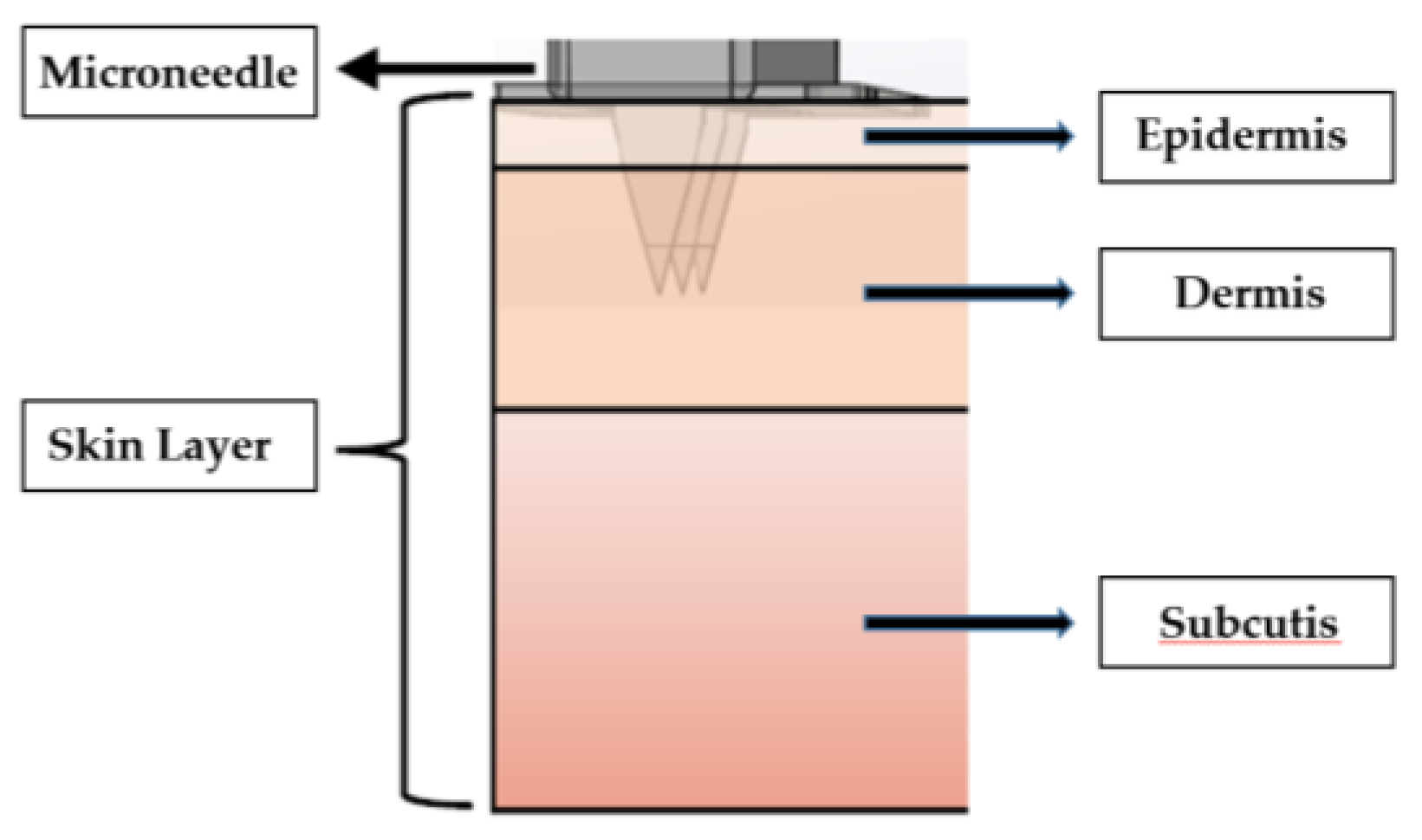 Sensors 22 01468 g004