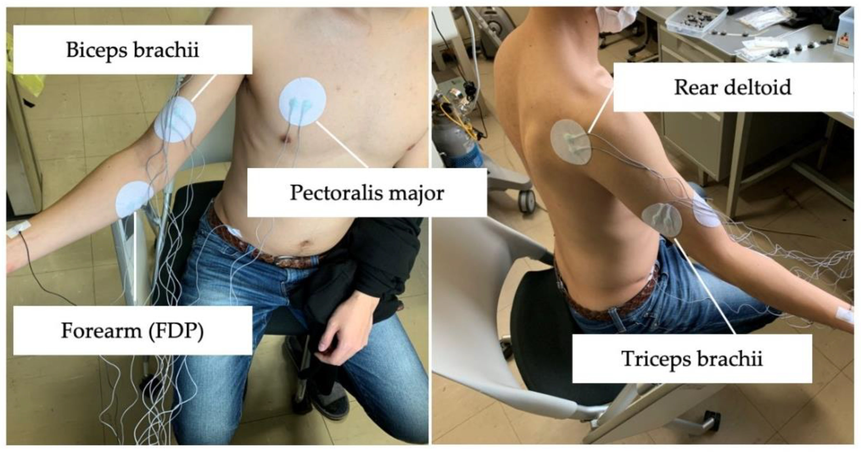 Sensors 22 01615 g005