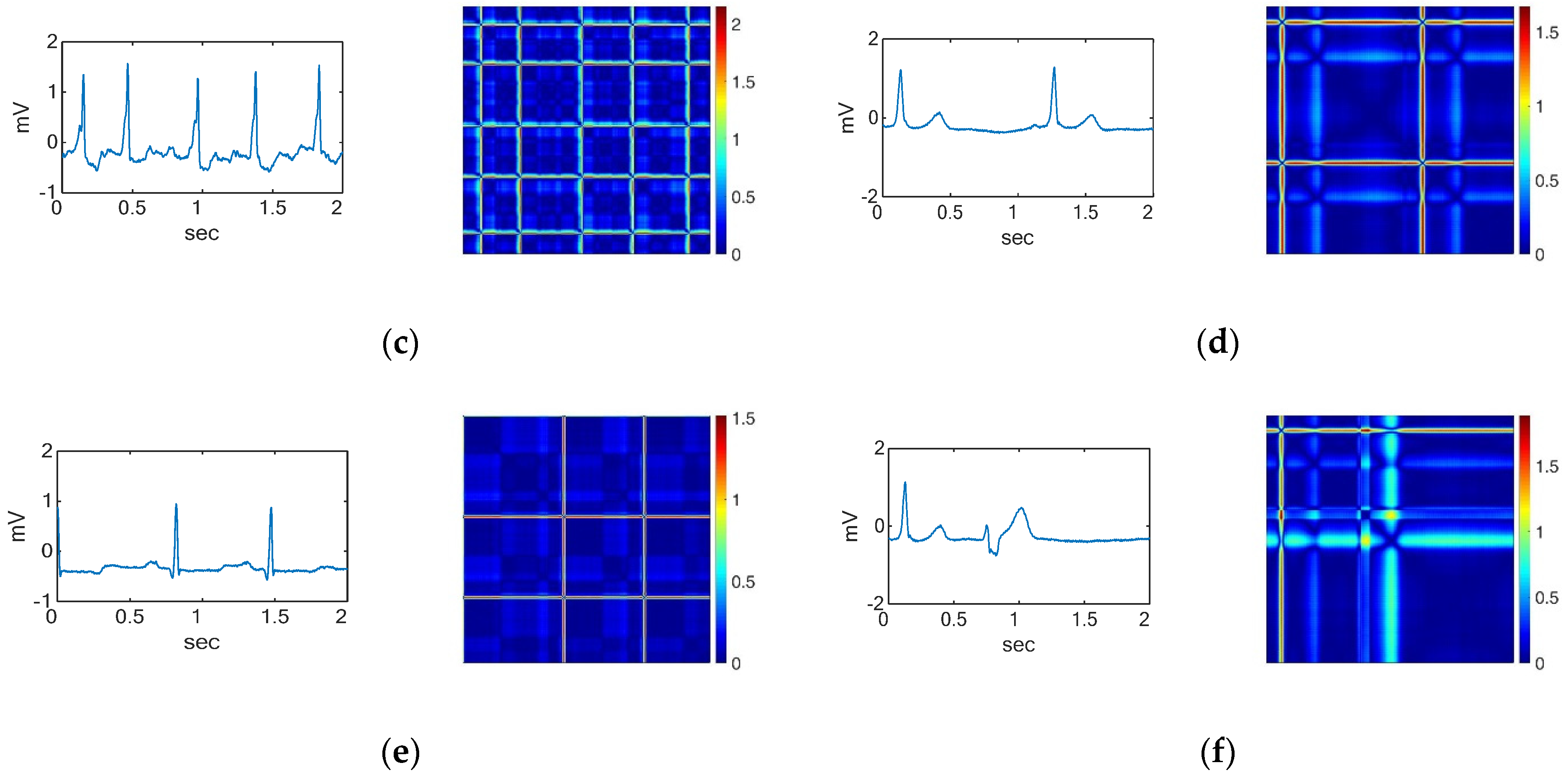 Sensors 22 01660 g002b