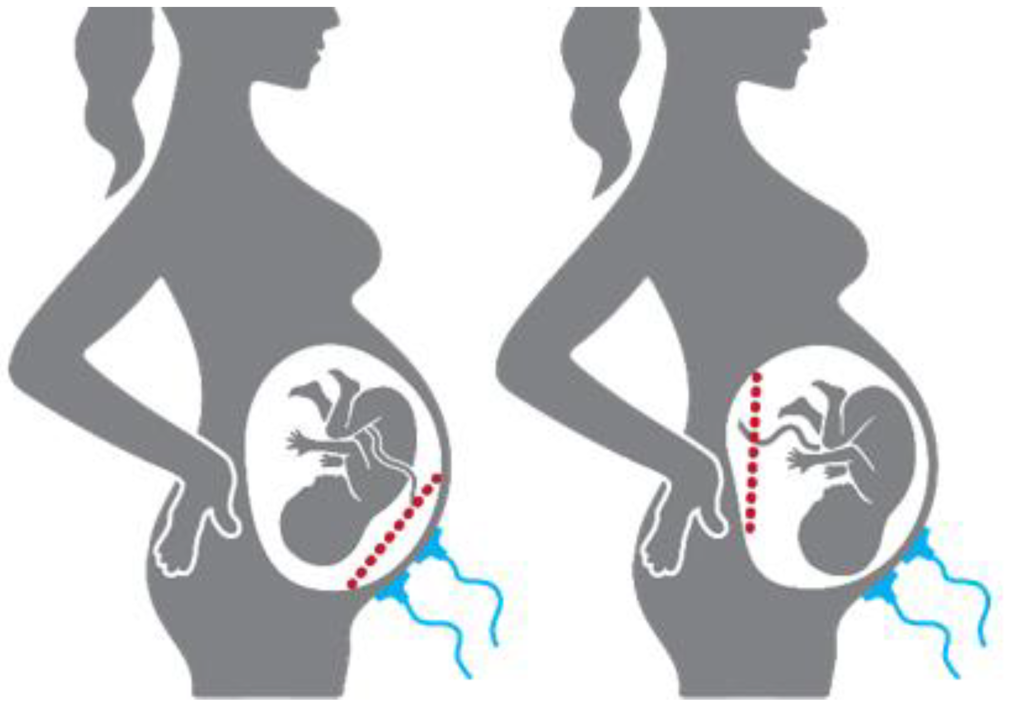 Sensors 22 01704 g001