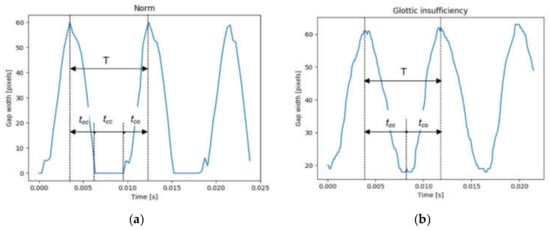 Sensors 22 01751 g0a1 550