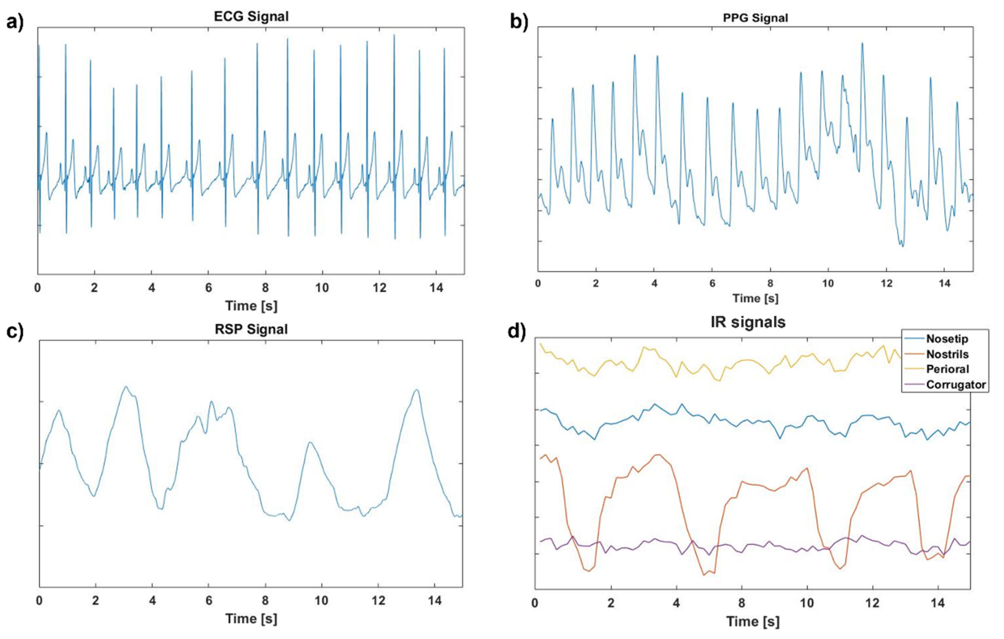 Sensors 22 01789 g002