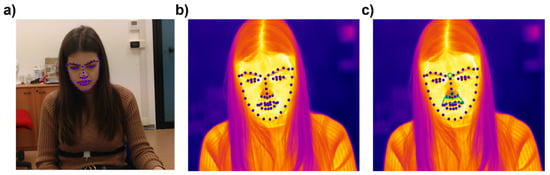 Sensors 22 01789 g003 550