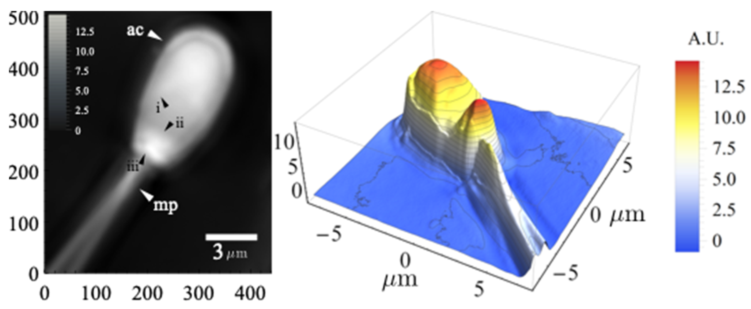 Sensors 22 01842 g005