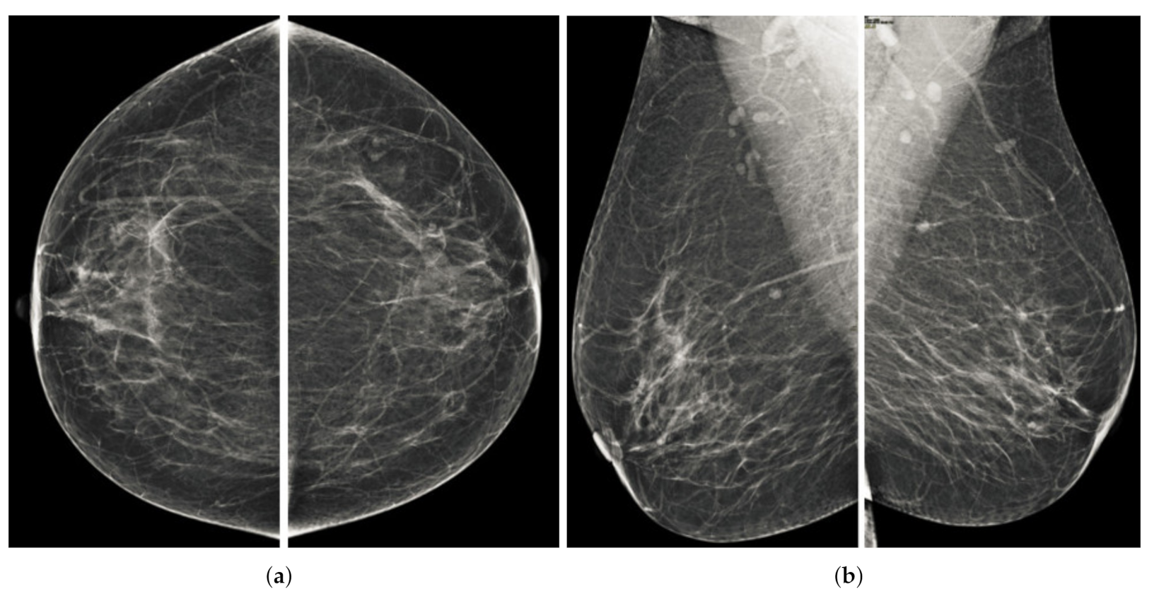 Sensors 22 01868 g001