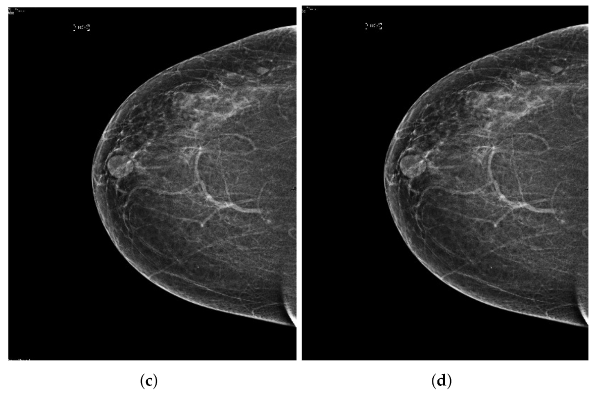 Sensors 22 01868 g003a