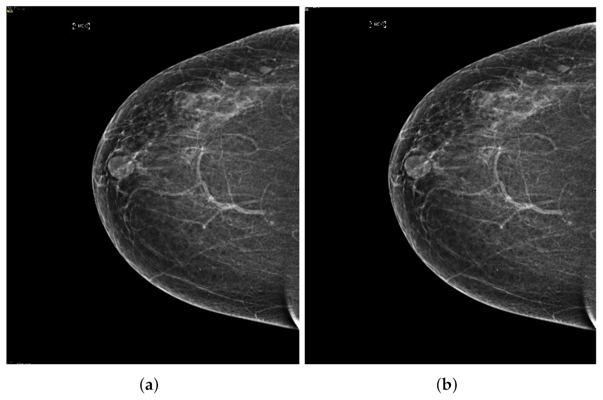 Sensors 22 01868 g003b