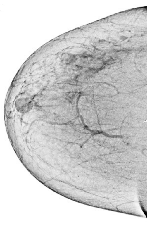 Sensors 22 01868 g005