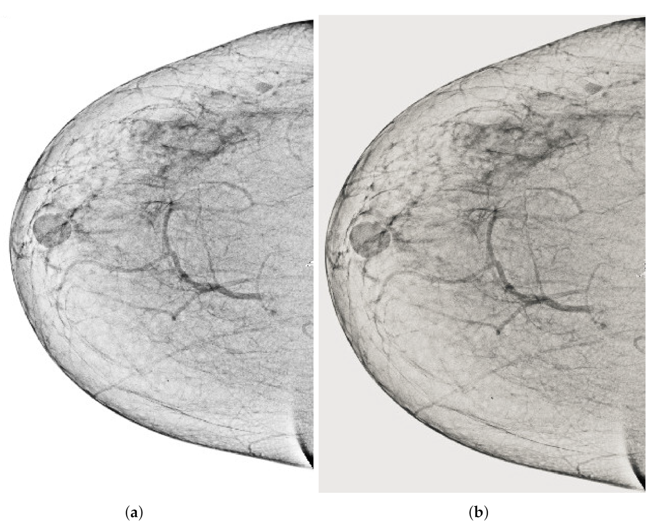 Sensors 22 01868 g006