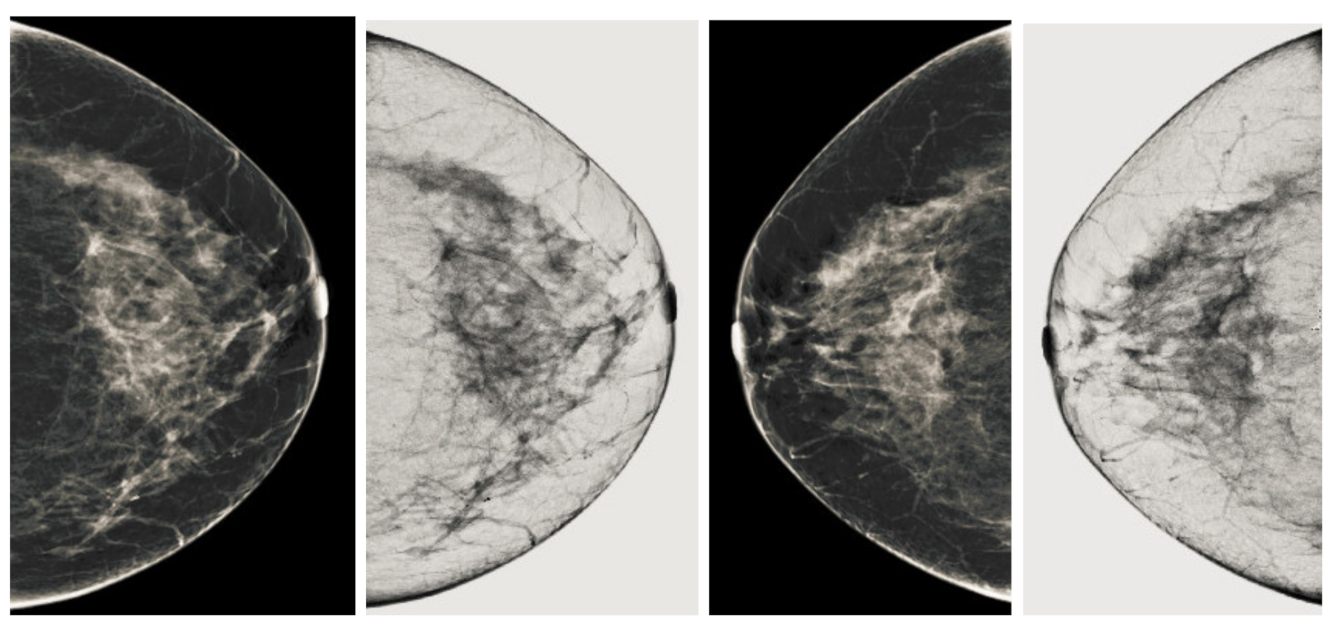 Sensors 22 01868 g009