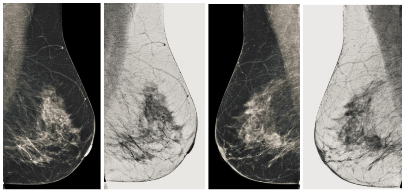 Sensors 22 01868 g010