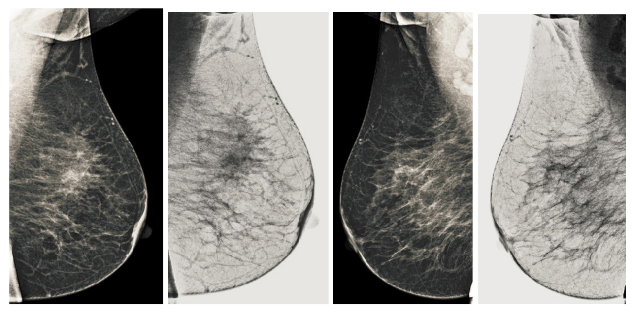 Sensors 22 01868 g012