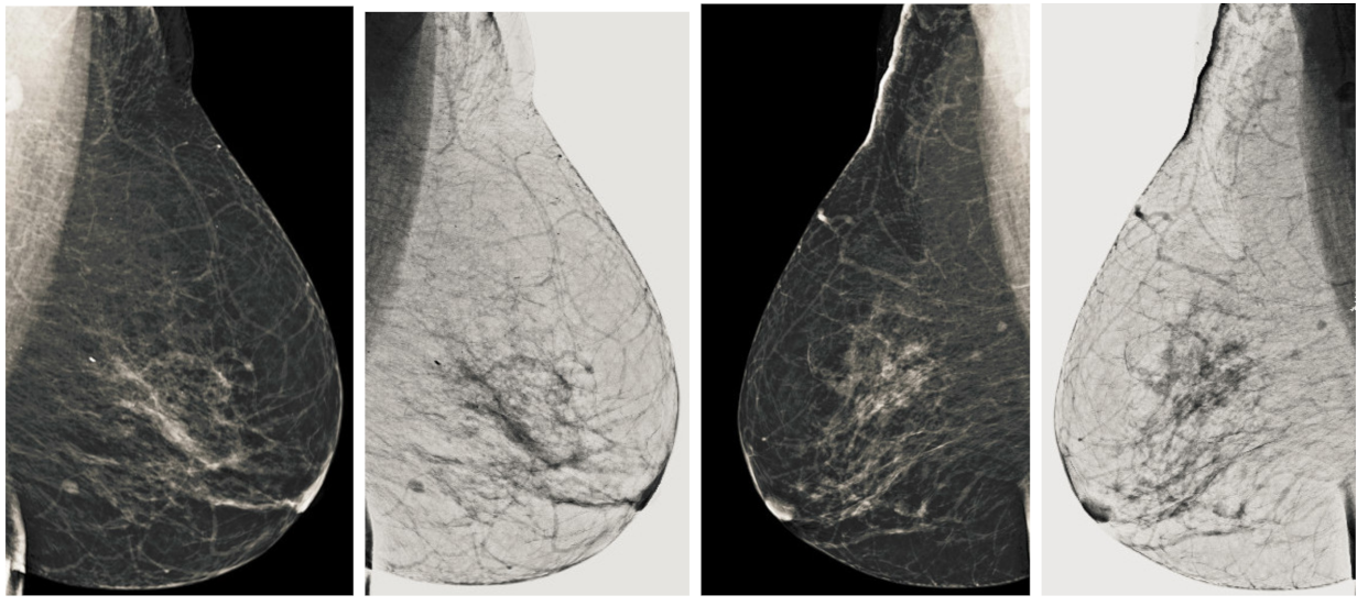 Sensors 22 01868 g014