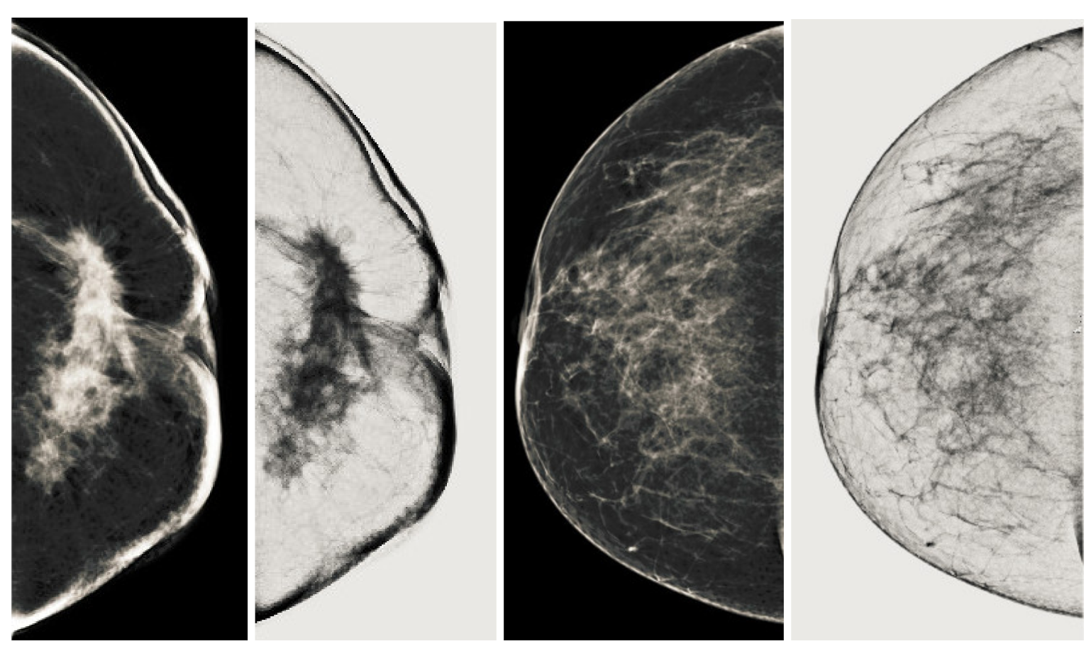 Sensors 22 01868 g015