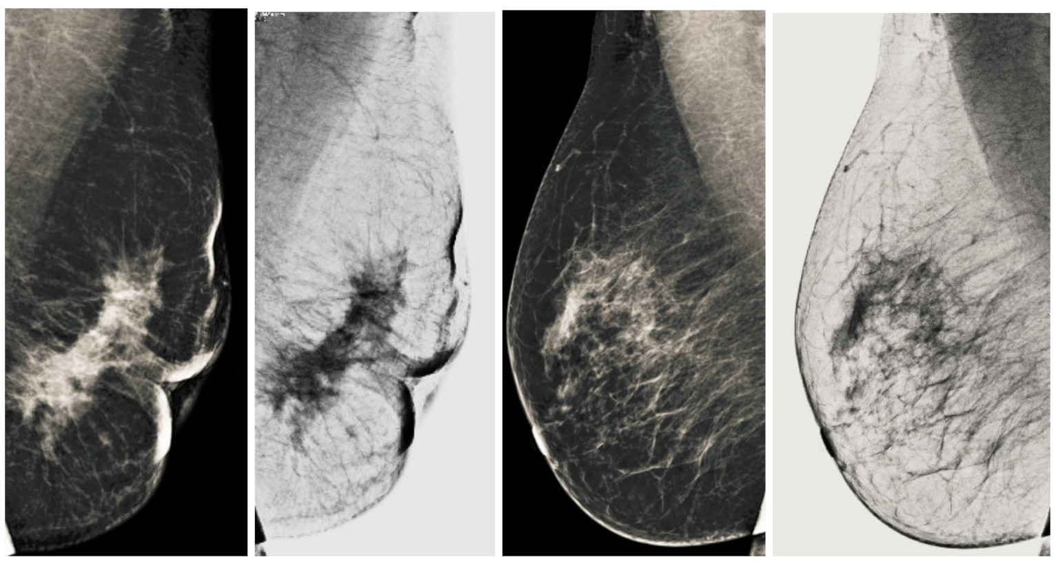 Sensors 22 01868 g016