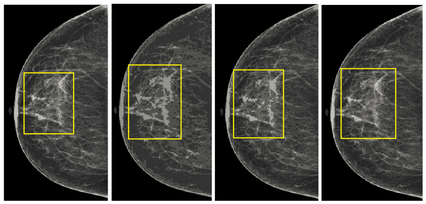 Sensors 22 01868 g017