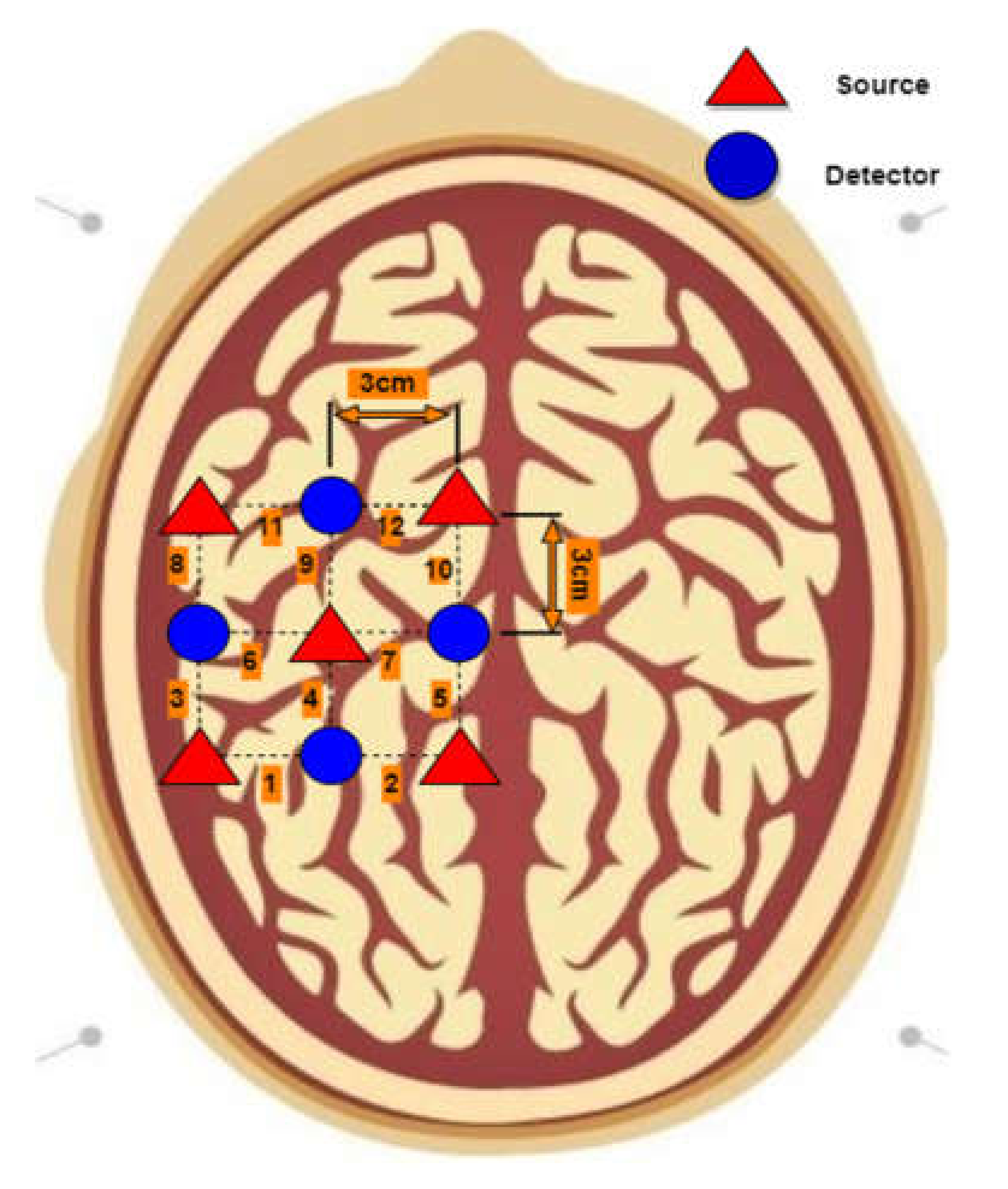 Sensors 22 01932 g004