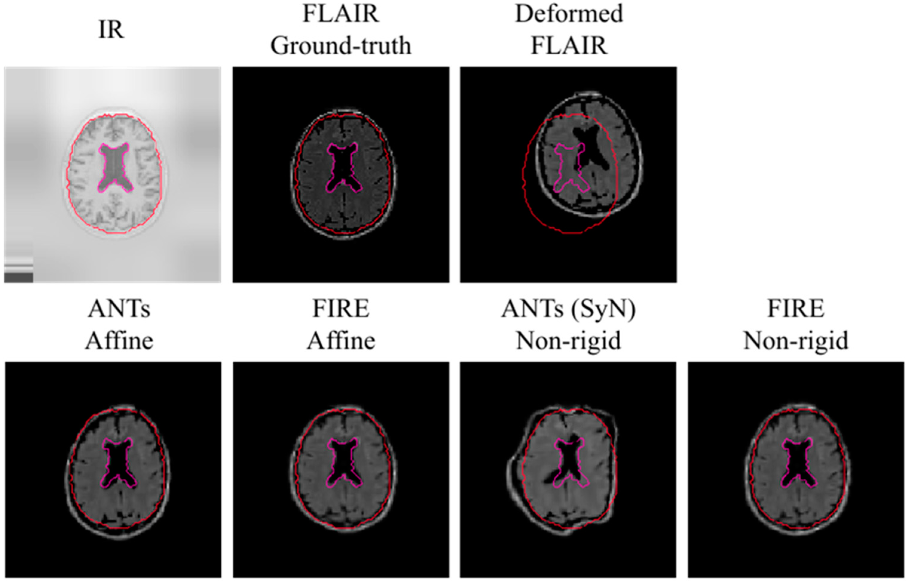 Sensors 22 02125 g006