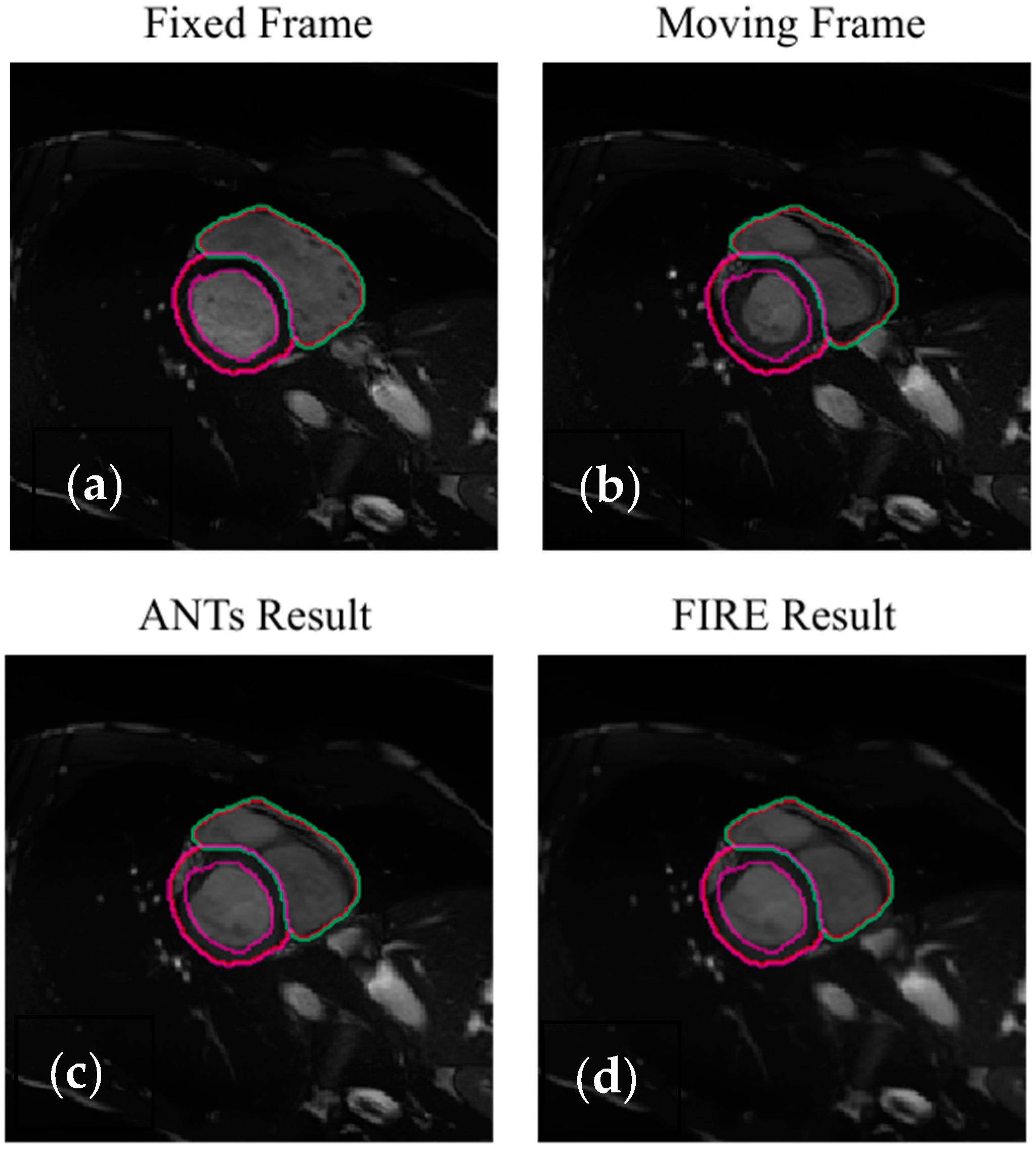 Sensors 22 02125 g007
