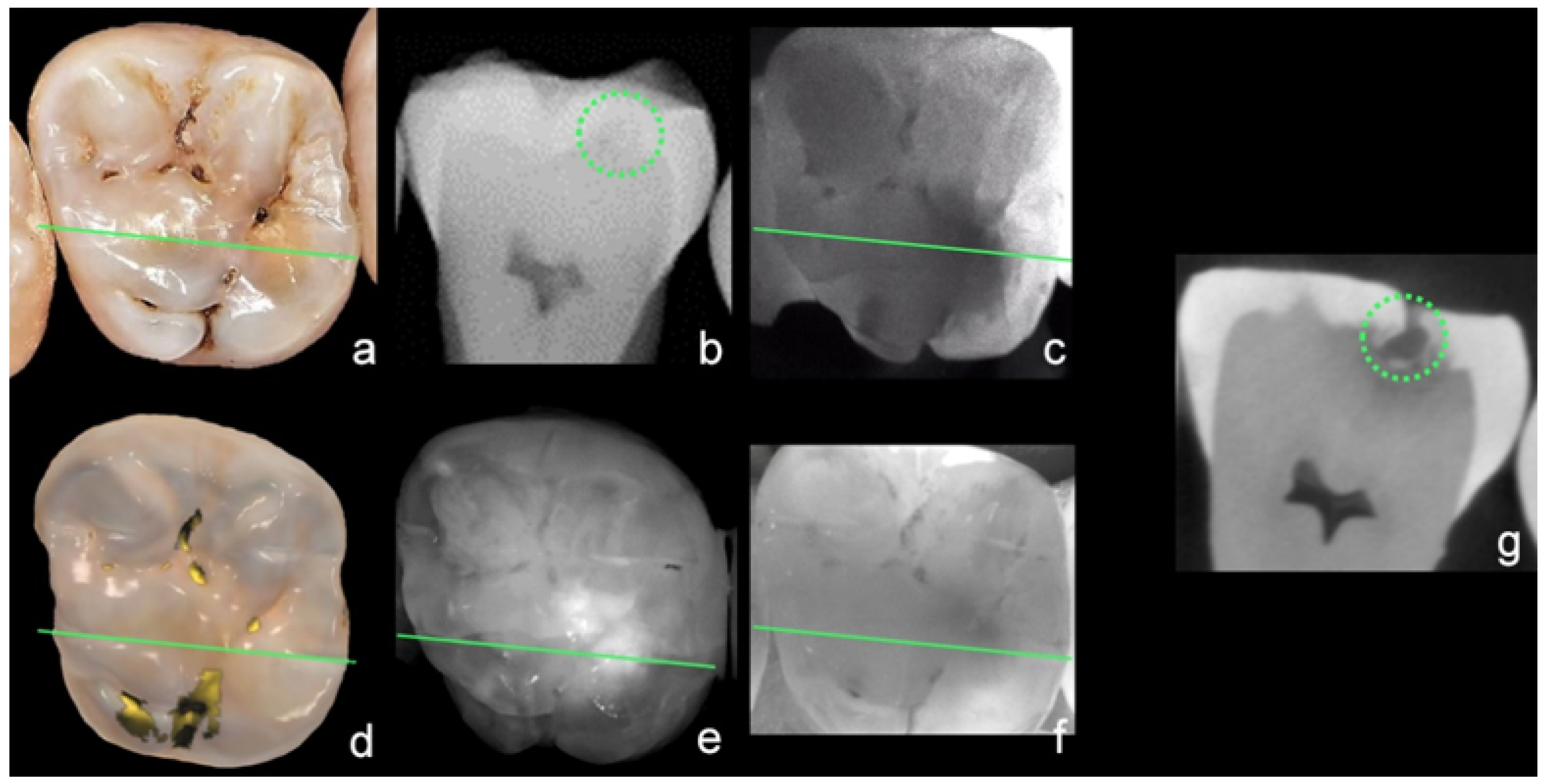 Sensors 22 02156 g008