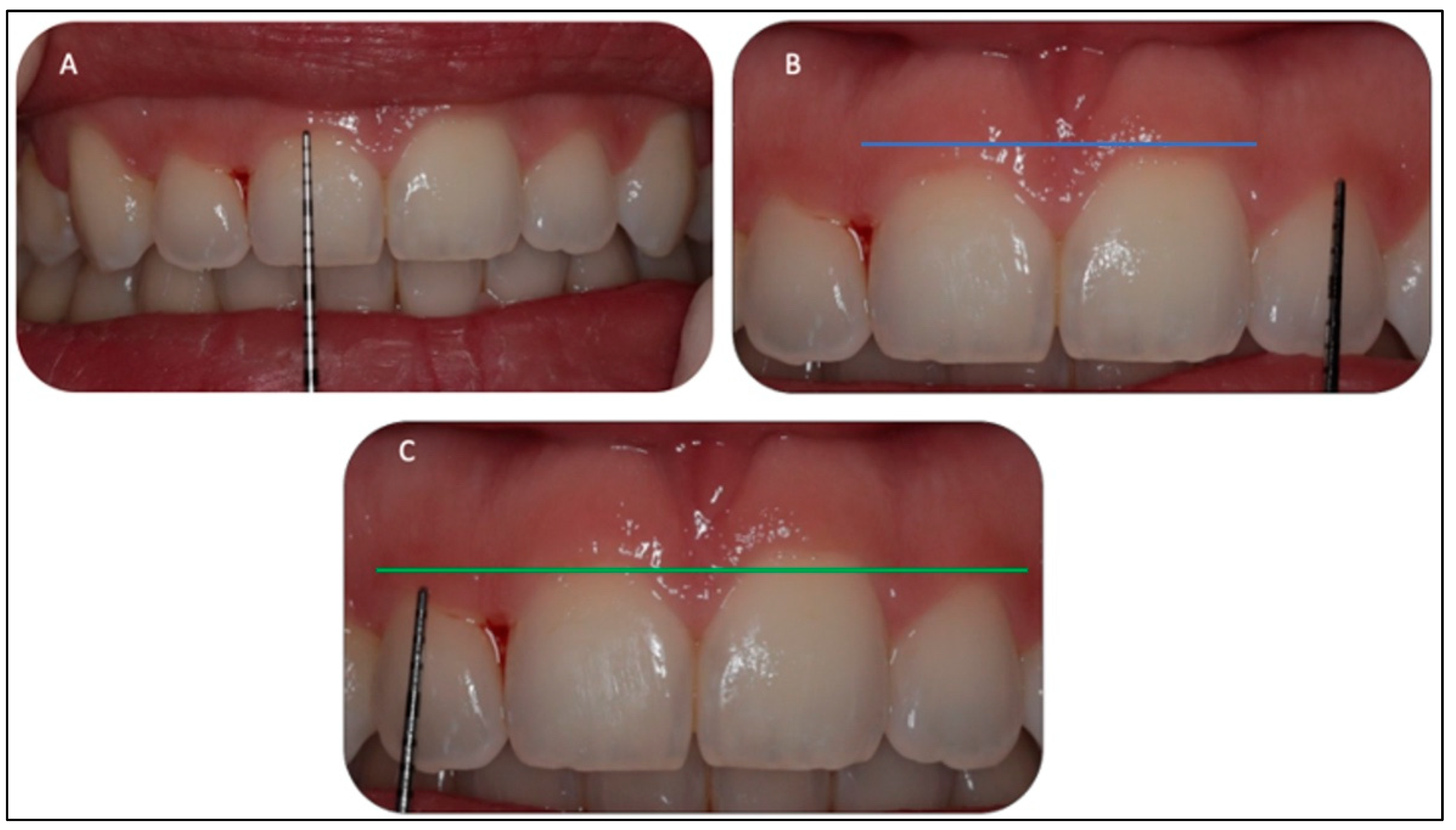 Sensors 22 02263 g003